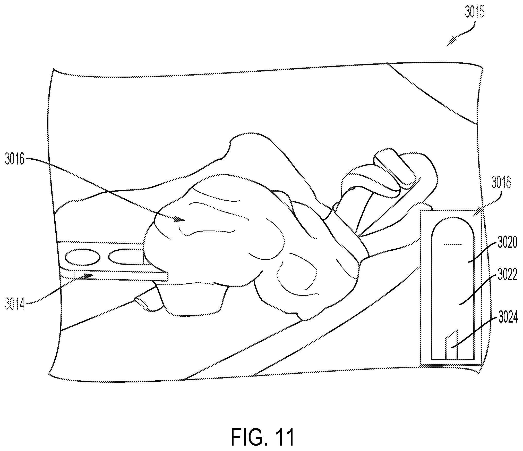 Patent US12599379 Figure 15 – Devices, systems, and methods for detecting tissue and foreign objects during a surgical operation
