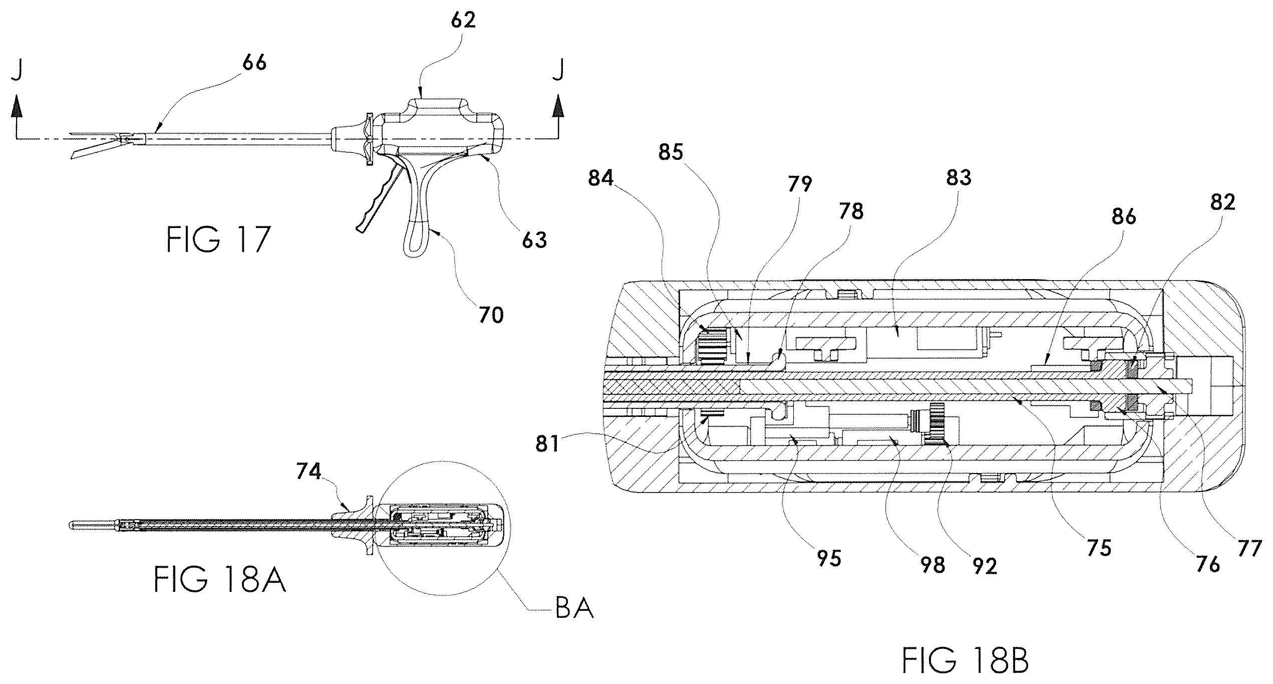 Patent US12599381 Figure 17 – Surgical stapler with removable power pack