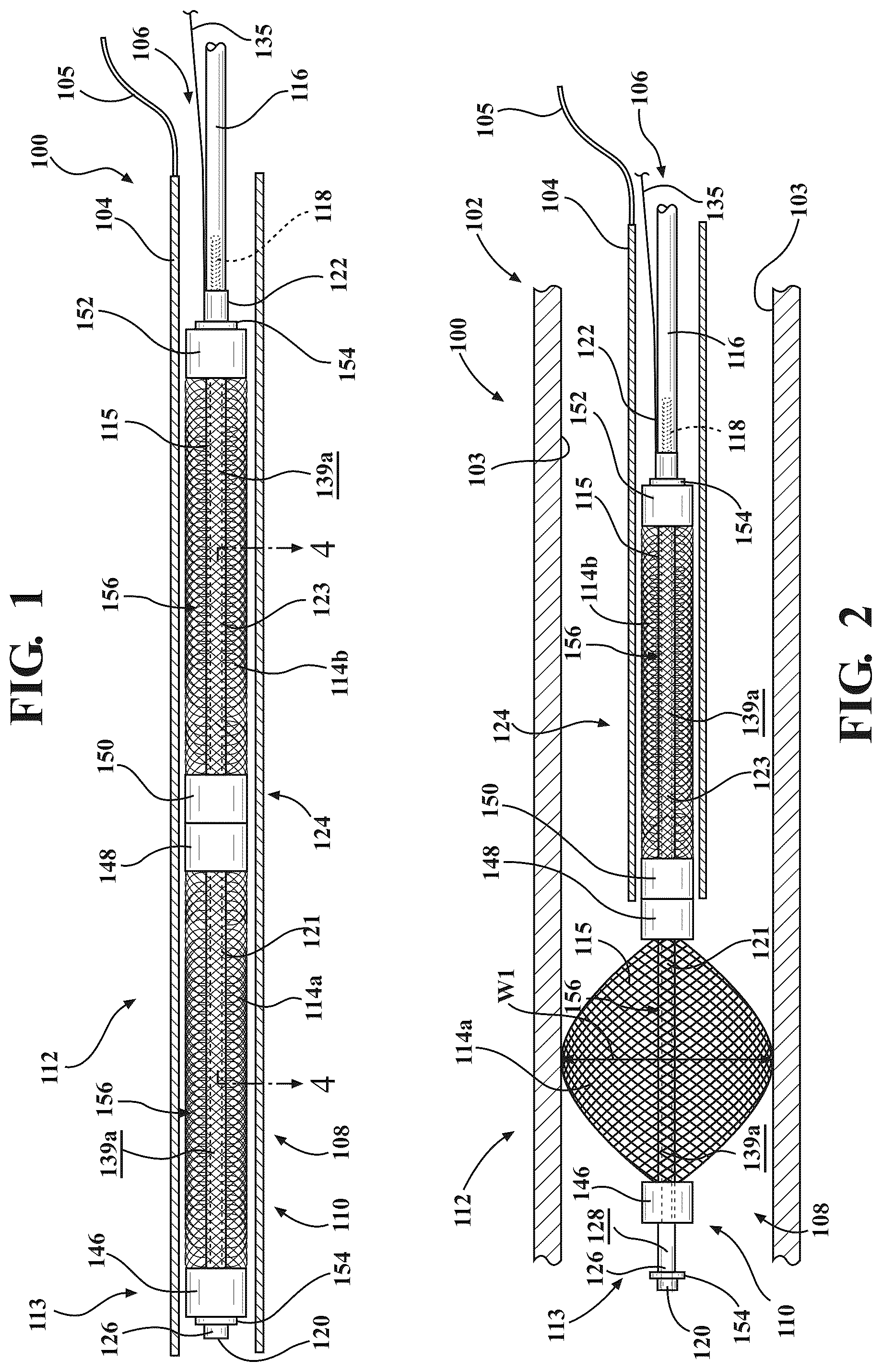 Patent US12599384 — Occlusion devices and methods of use thereof — Figure 1