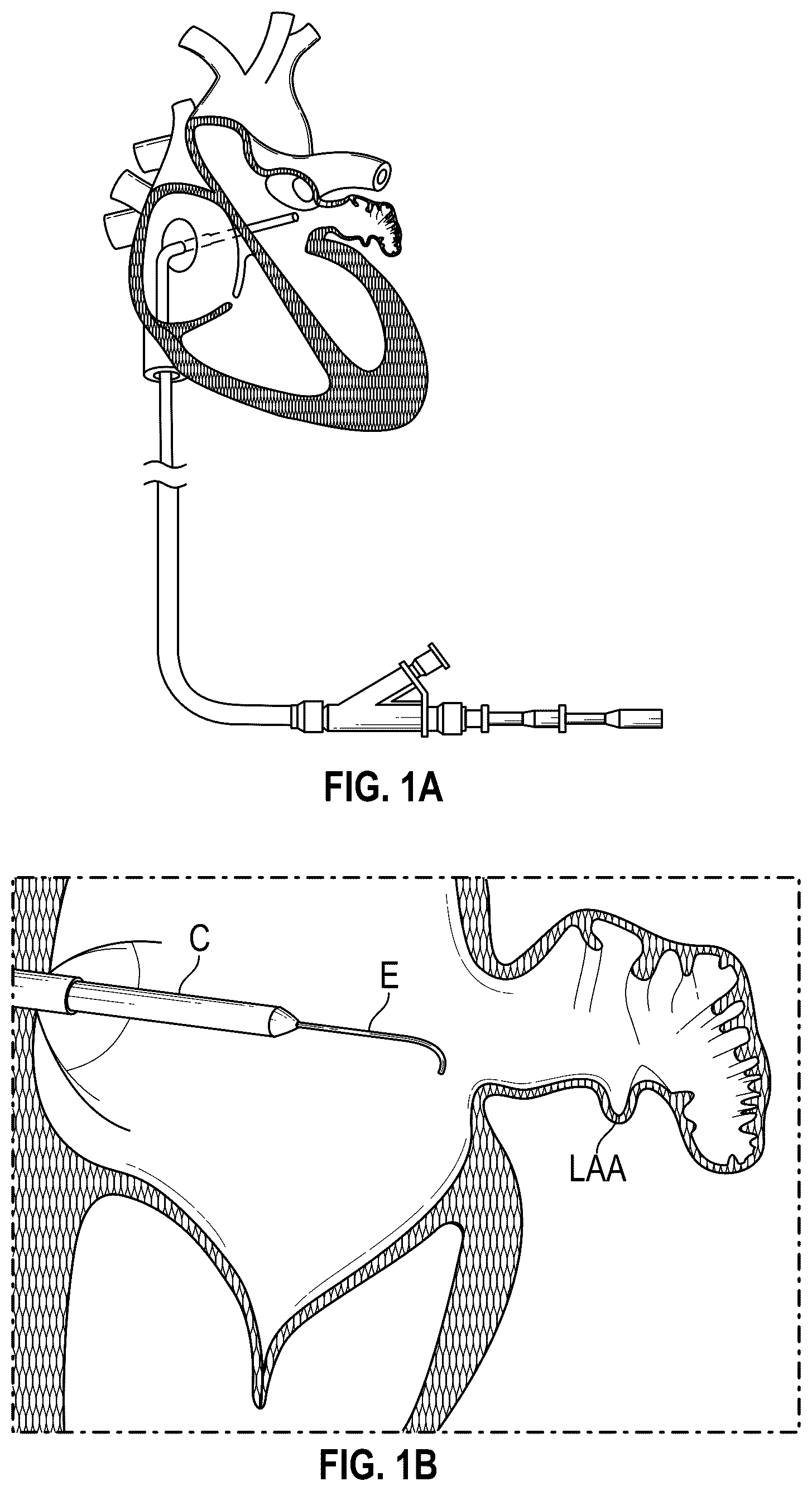 Patent US12599386 — Devices, systems, and methods for treating the left atrial appendage — Figure 1