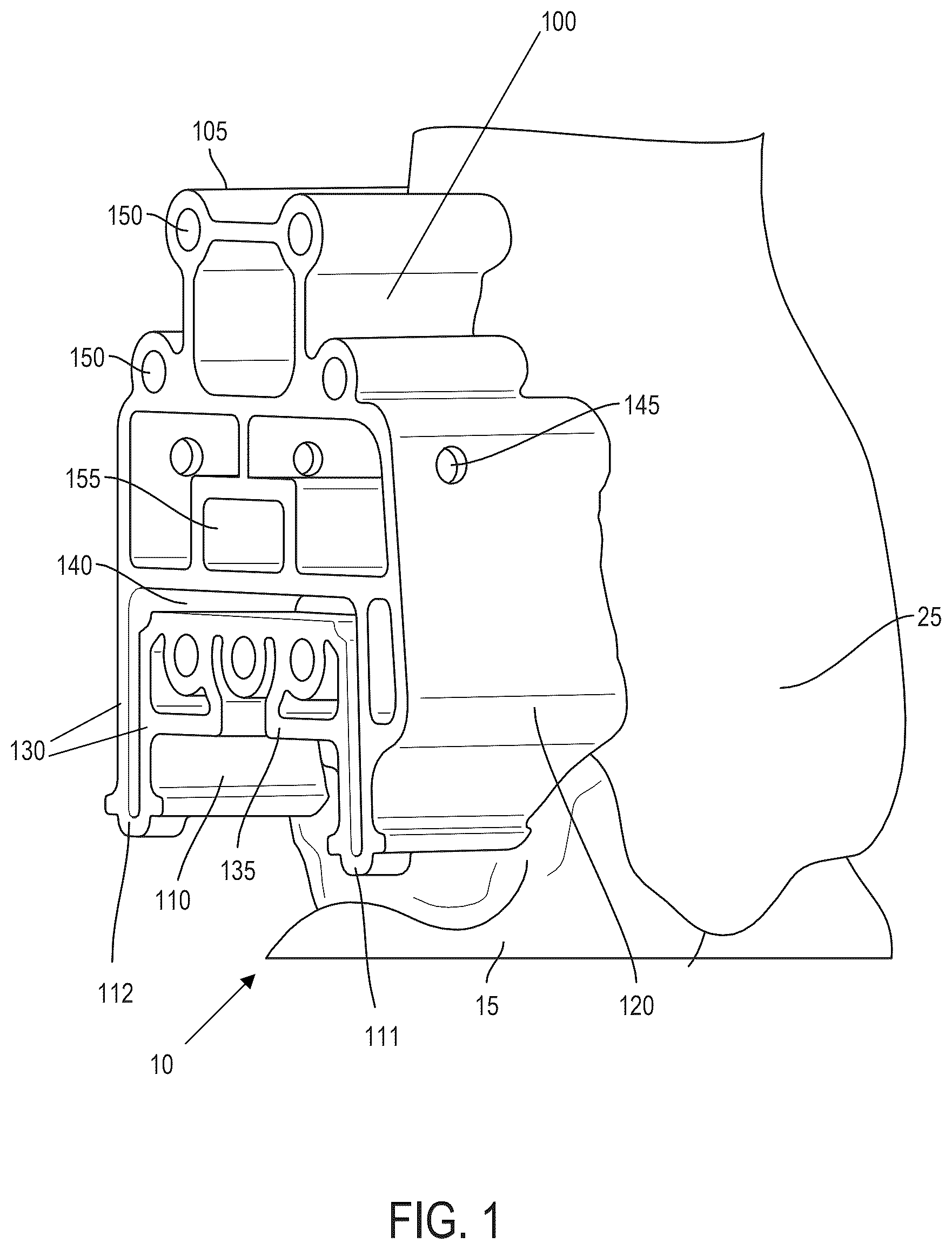 Patent US12599390 — Surgical guides and processes for producing and using the same — Figure 1