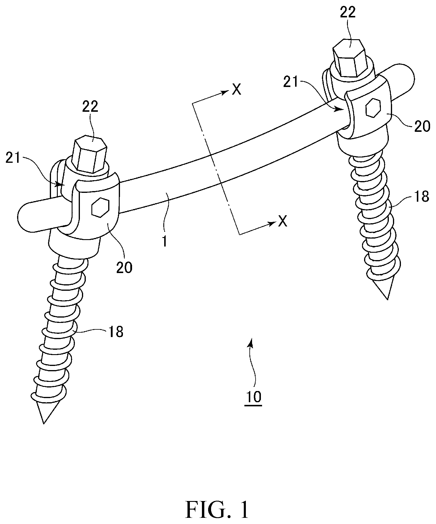 Patent US12599411 — Rod for spinal brace — Figure 1