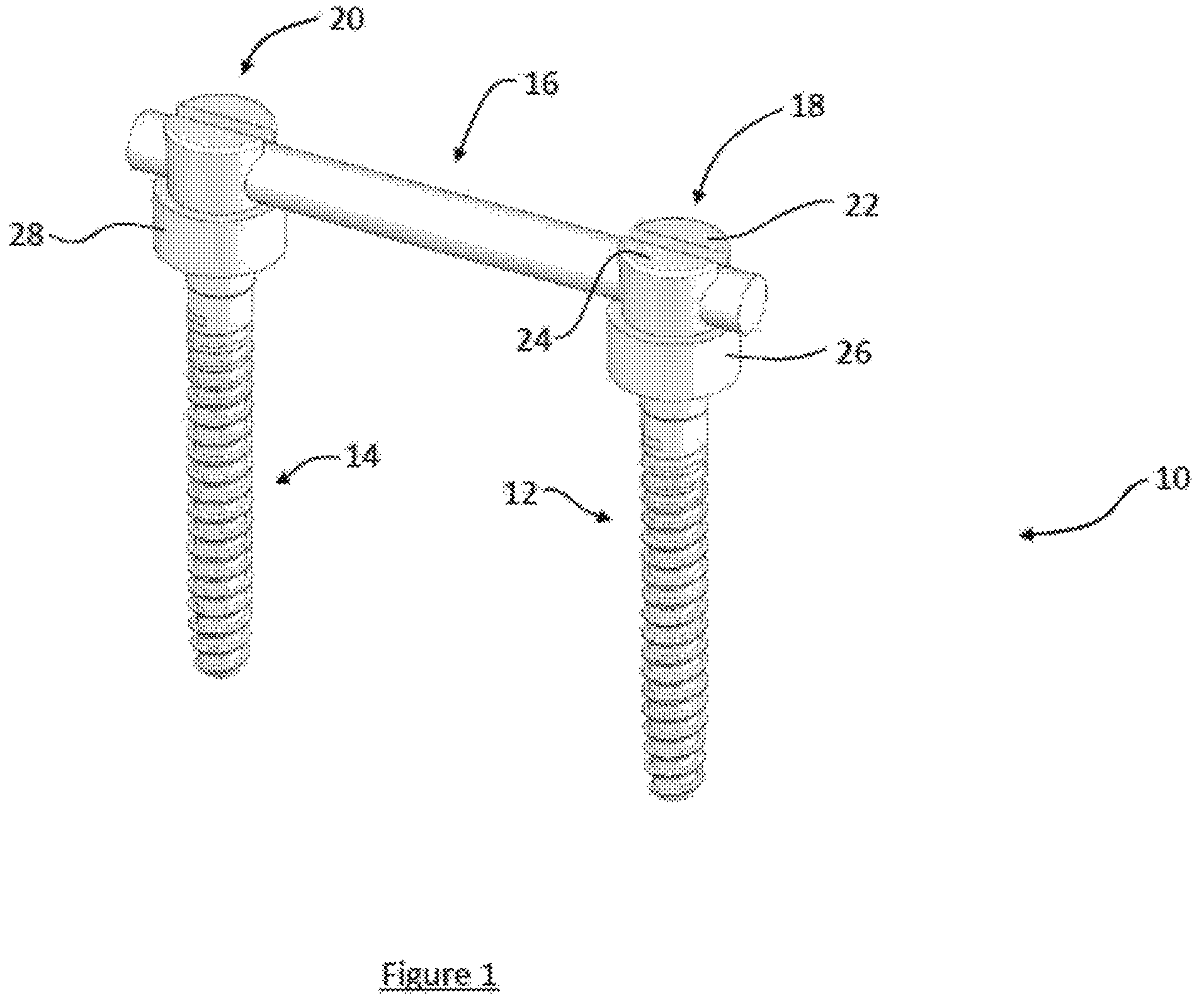 Patent US12599413 — Composite material spinal implant — Figure 1