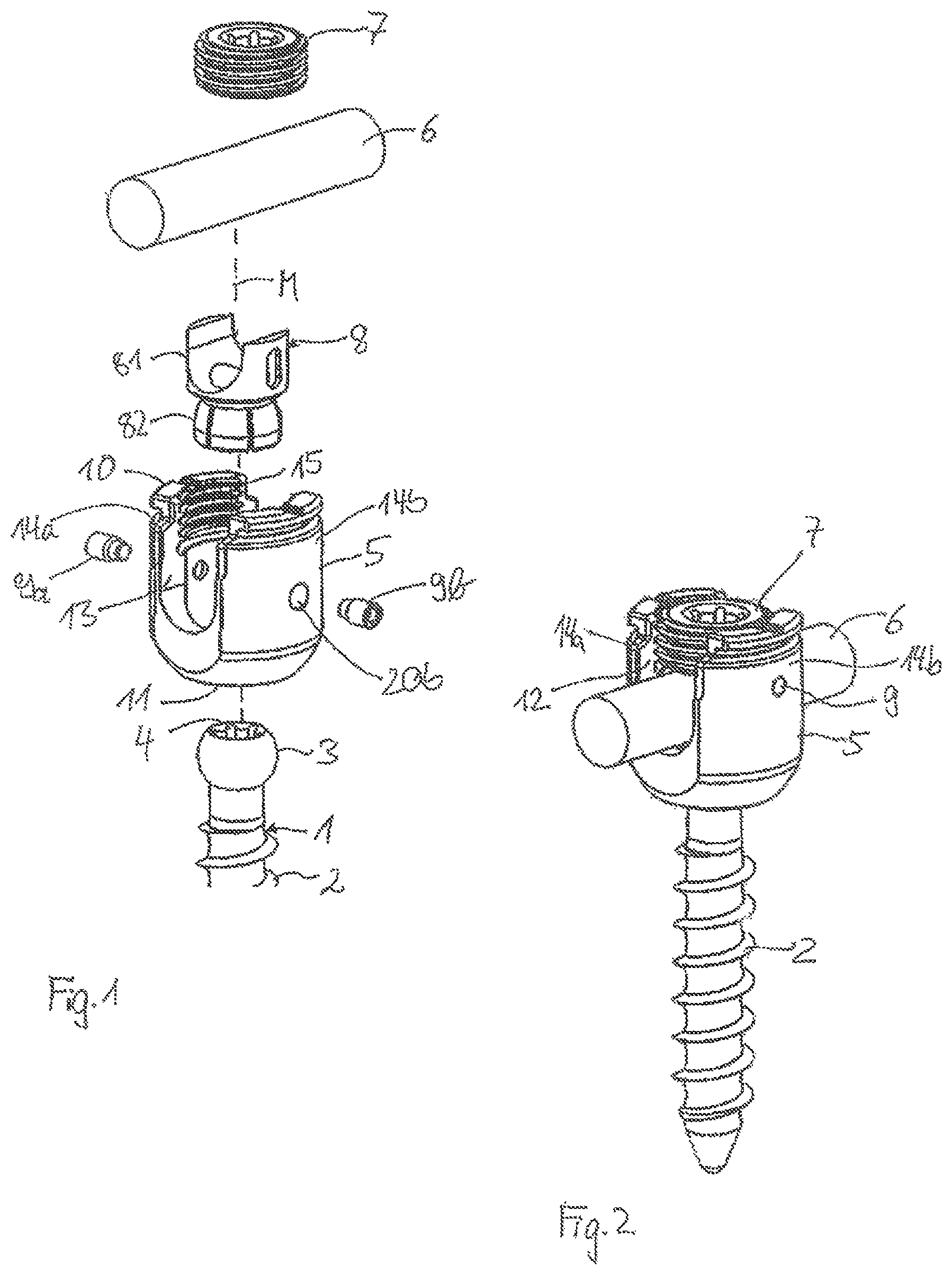 Patent US12599414 — Receiving part for receiving a rod for coupling the rod to a bone anchoring element and a bone anchoring device with such a receiving part — Figure 1
