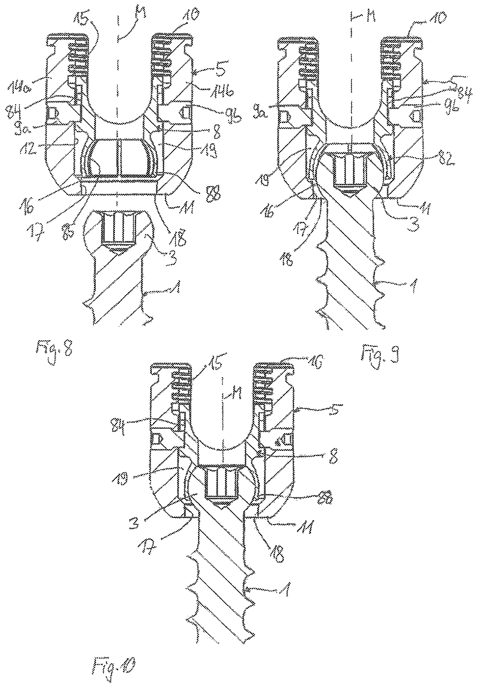 Patent US12599414 Figure 3 – Receiving part for receiving a rod for coupling the rod to a bone anchoring element and a bone anchoring device with such a receiving part