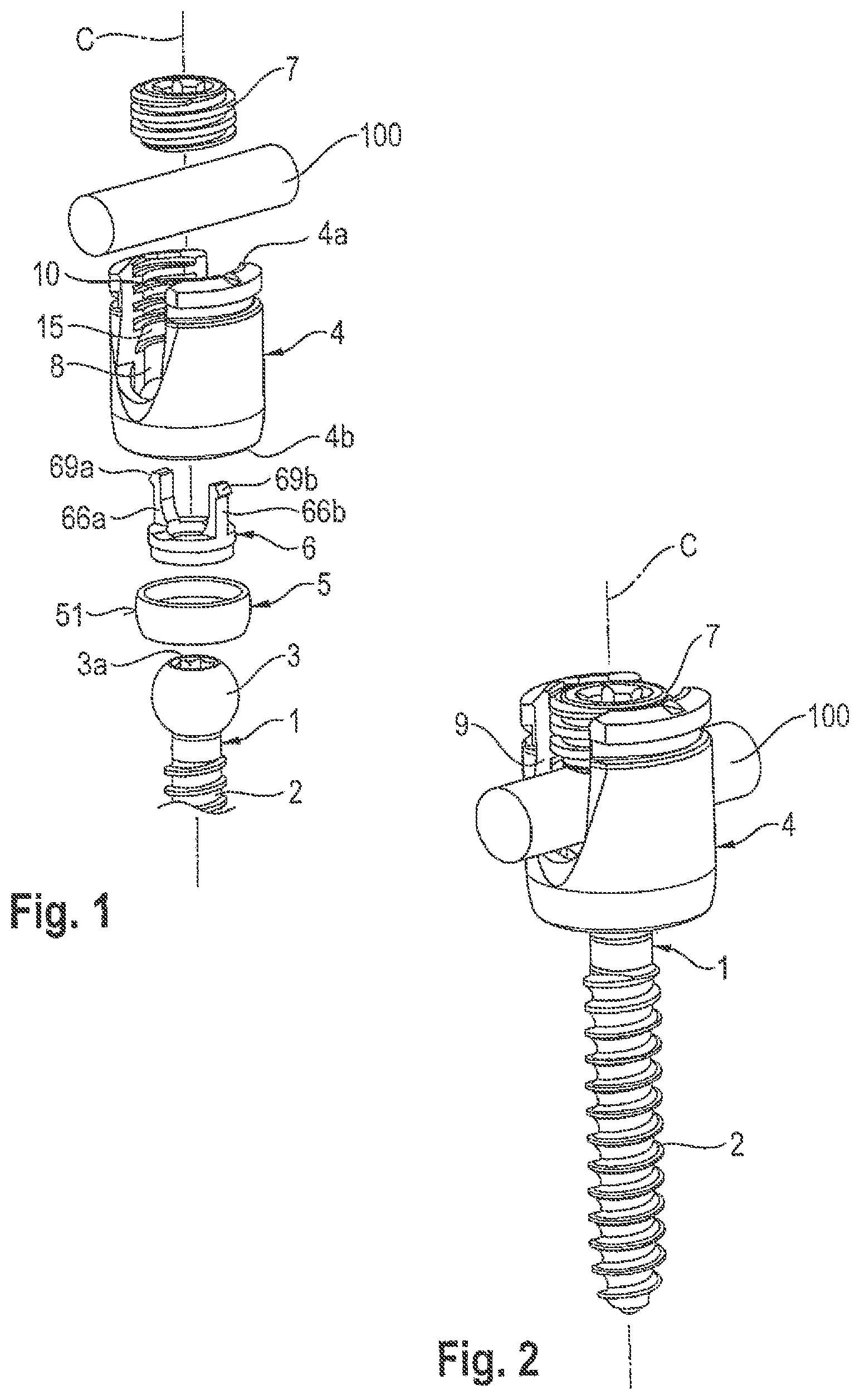 Patent US12599415 — Polyaxial bone anchoring device — Figure 1