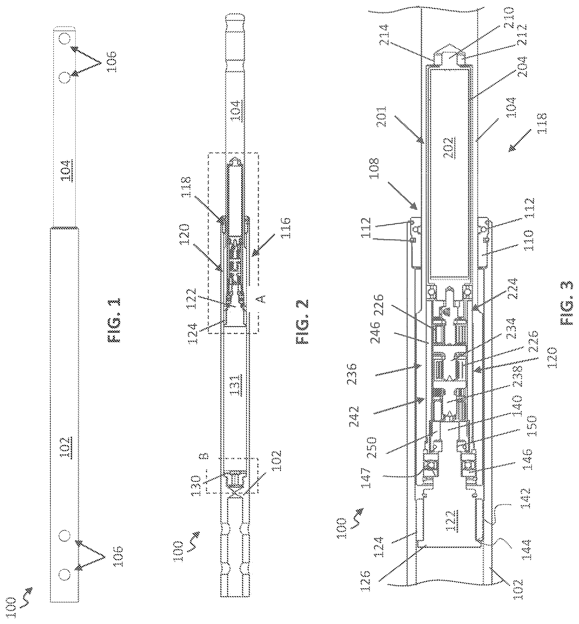 Patent US12599416 Figure 1 – Adjustable implant