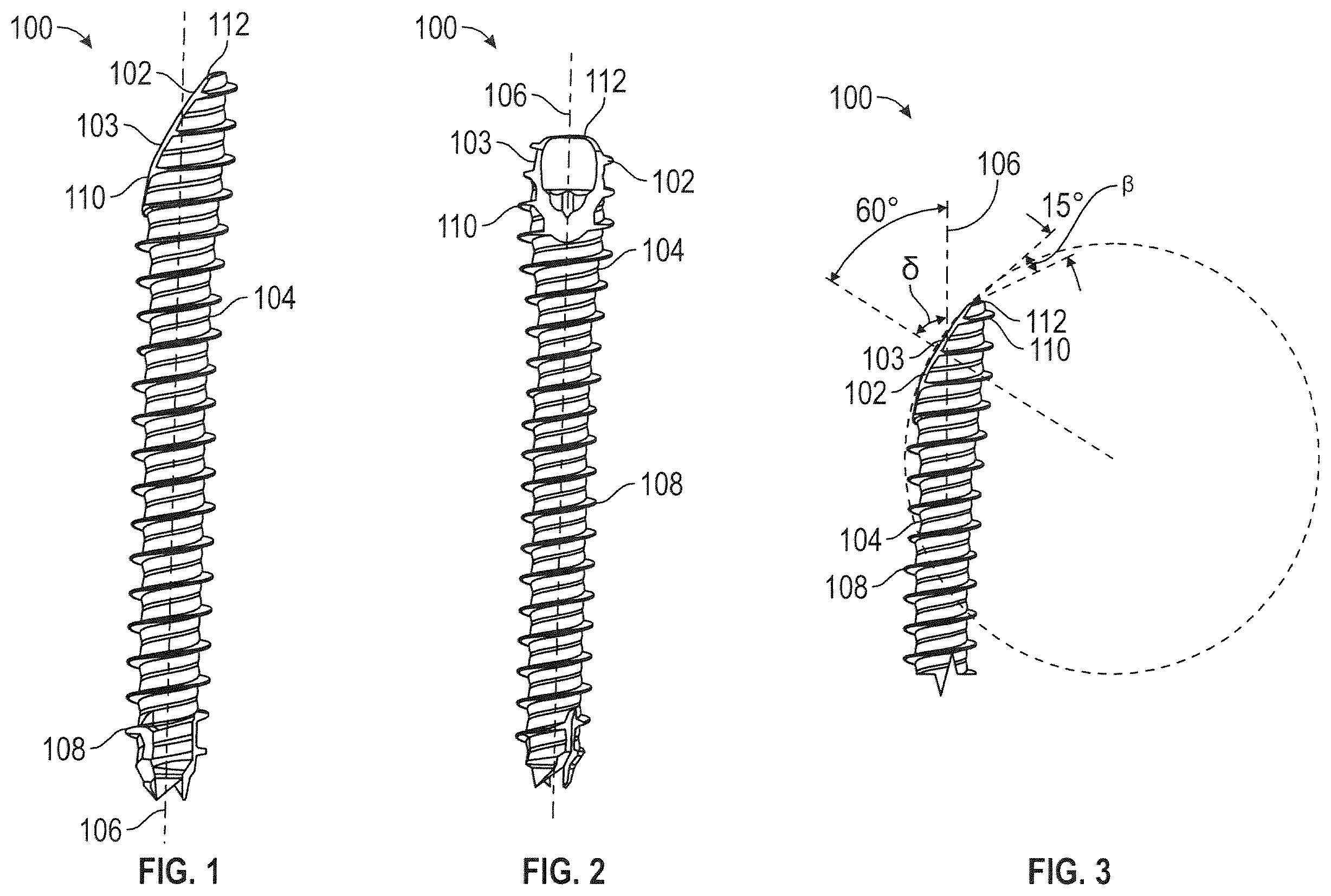 Patent US12599419 Figure 1 – Beveled screw