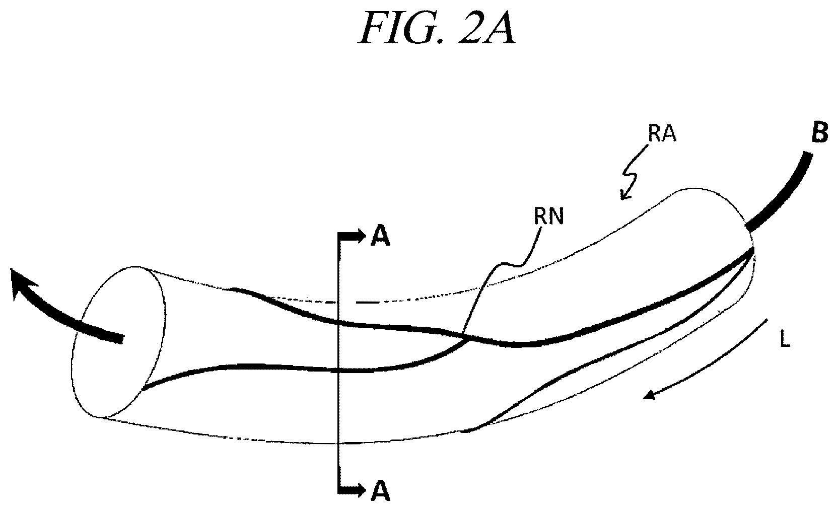 Patent US12599425 Figure 2 – Systems for perivascular nerve denervation