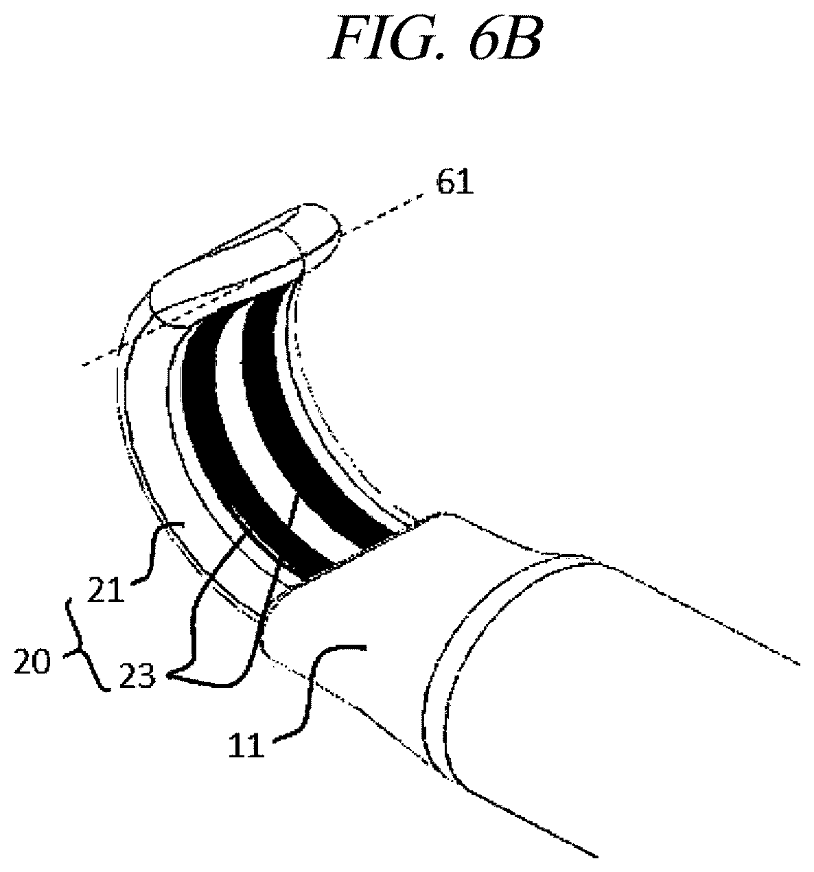 Patent US12599425 Figure 8 – Systems for perivascular nerve denervation