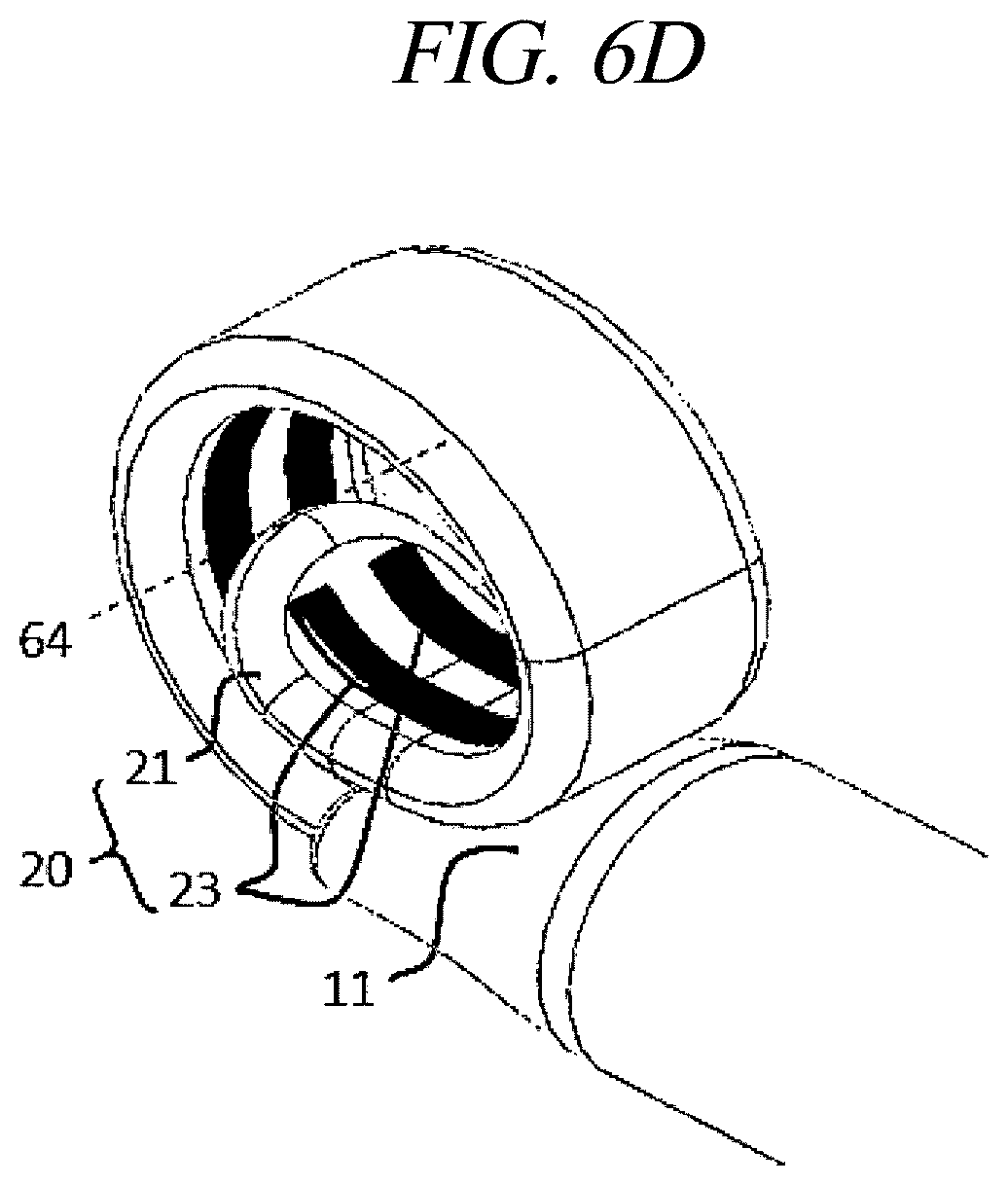 Patent US12599425 Figure 10 – Systems for perivascular nerve denervation