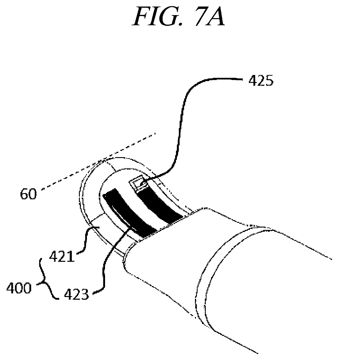 Patent US12599425 Figure 11 – Systems for perivascular nerve denervation