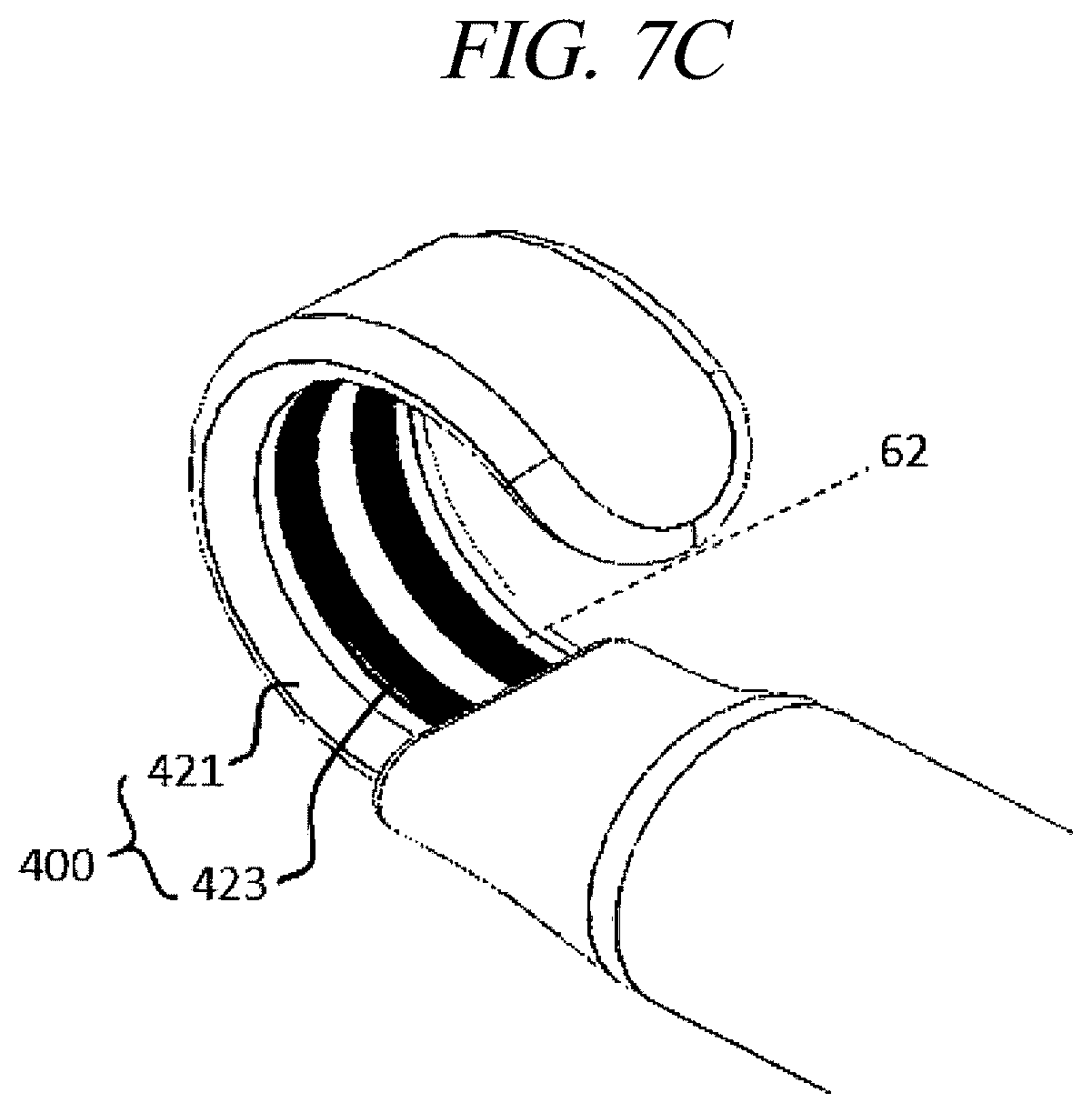 Patent US12599425 Figure 13 – Systems for perivascular nerve denervation