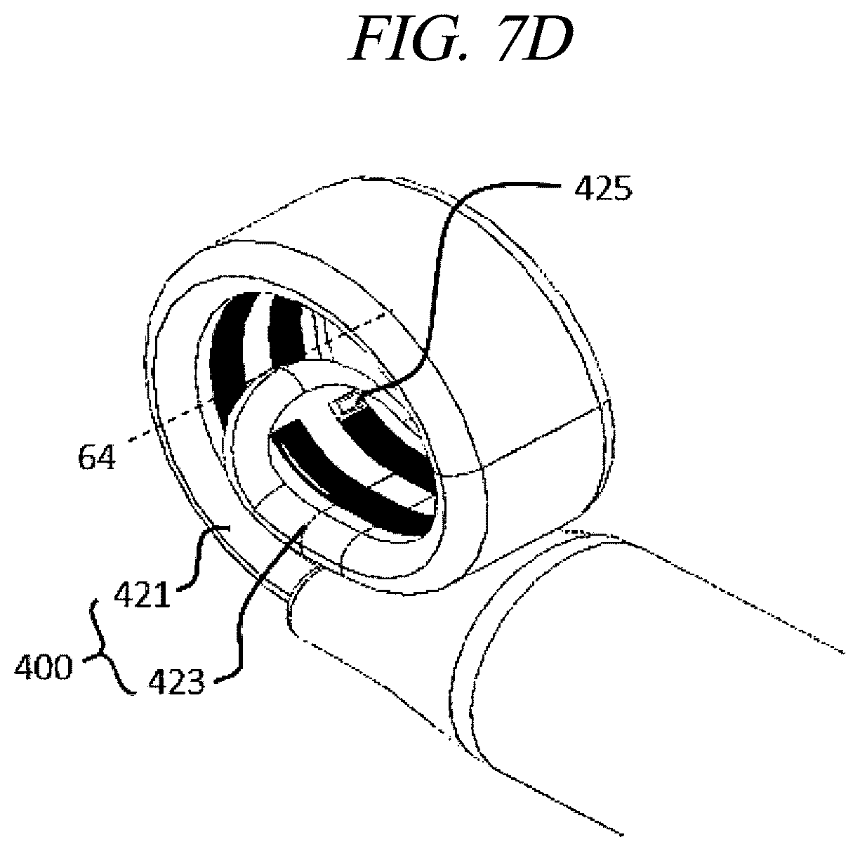 Patent US12599425 Figure 14 – Systems for perivascular nerve denervation