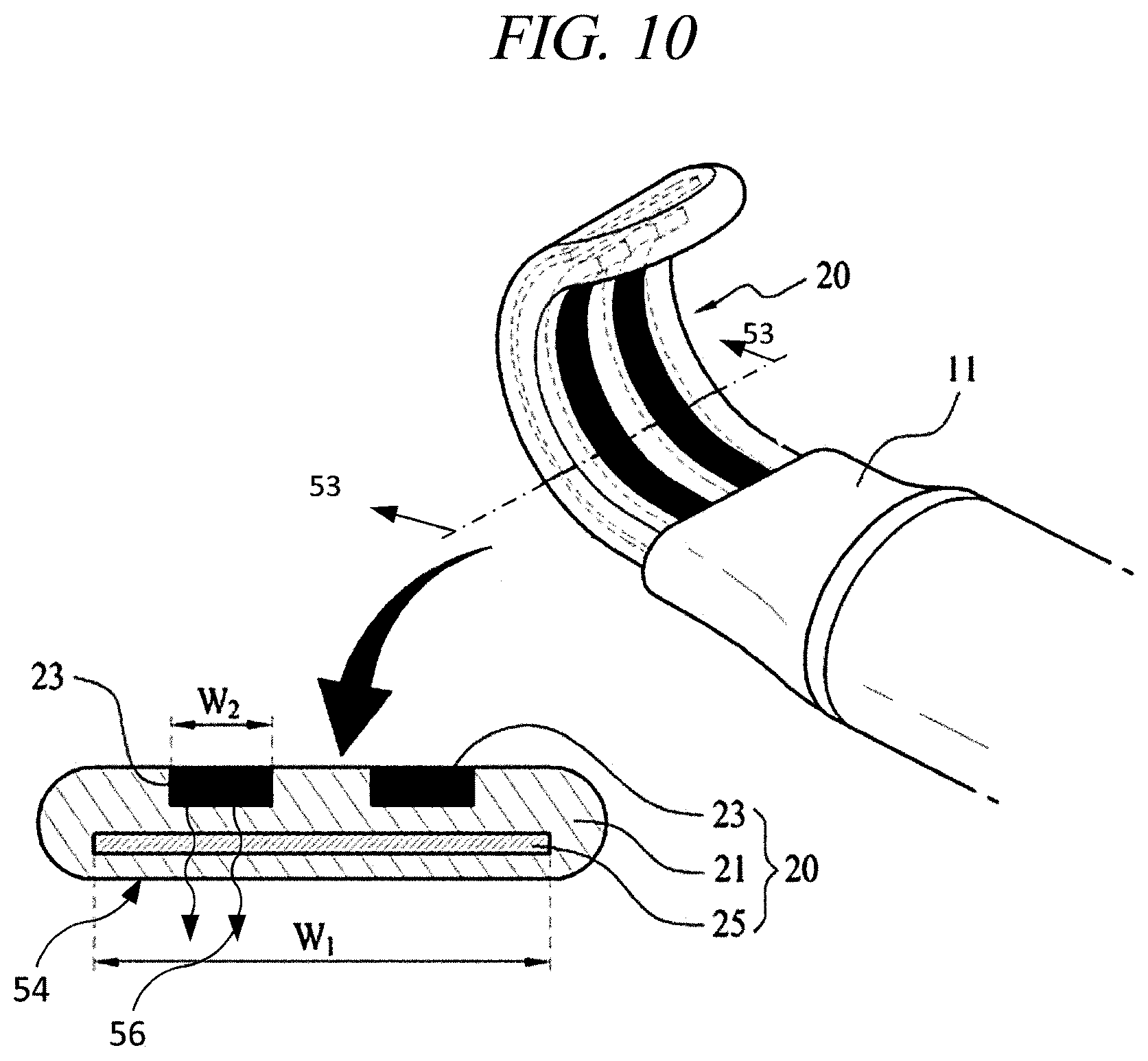 Patent US12599425 Figure 17 – Systems for perivascular nerve denervation