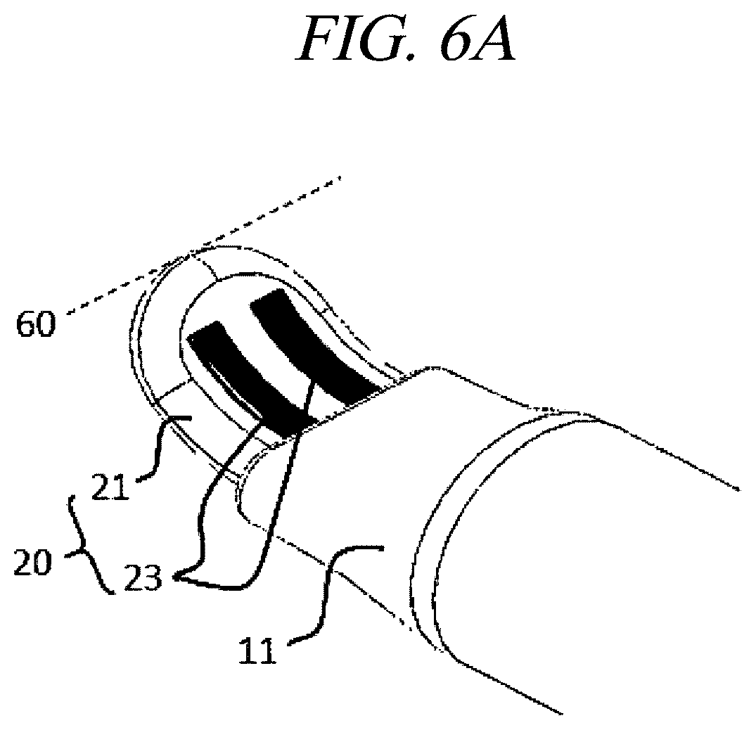 Patent US12599430 Figure 7 – Systems and methods for perivascular nerve denervation