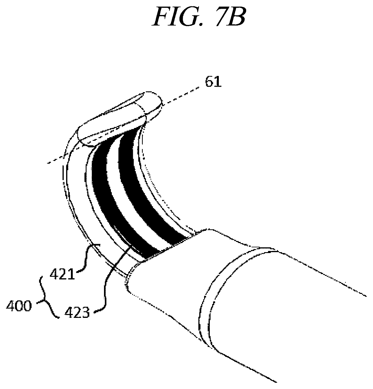 Patent US12599430 Figure 12 – Systems and methods for perivascular nerve denervation