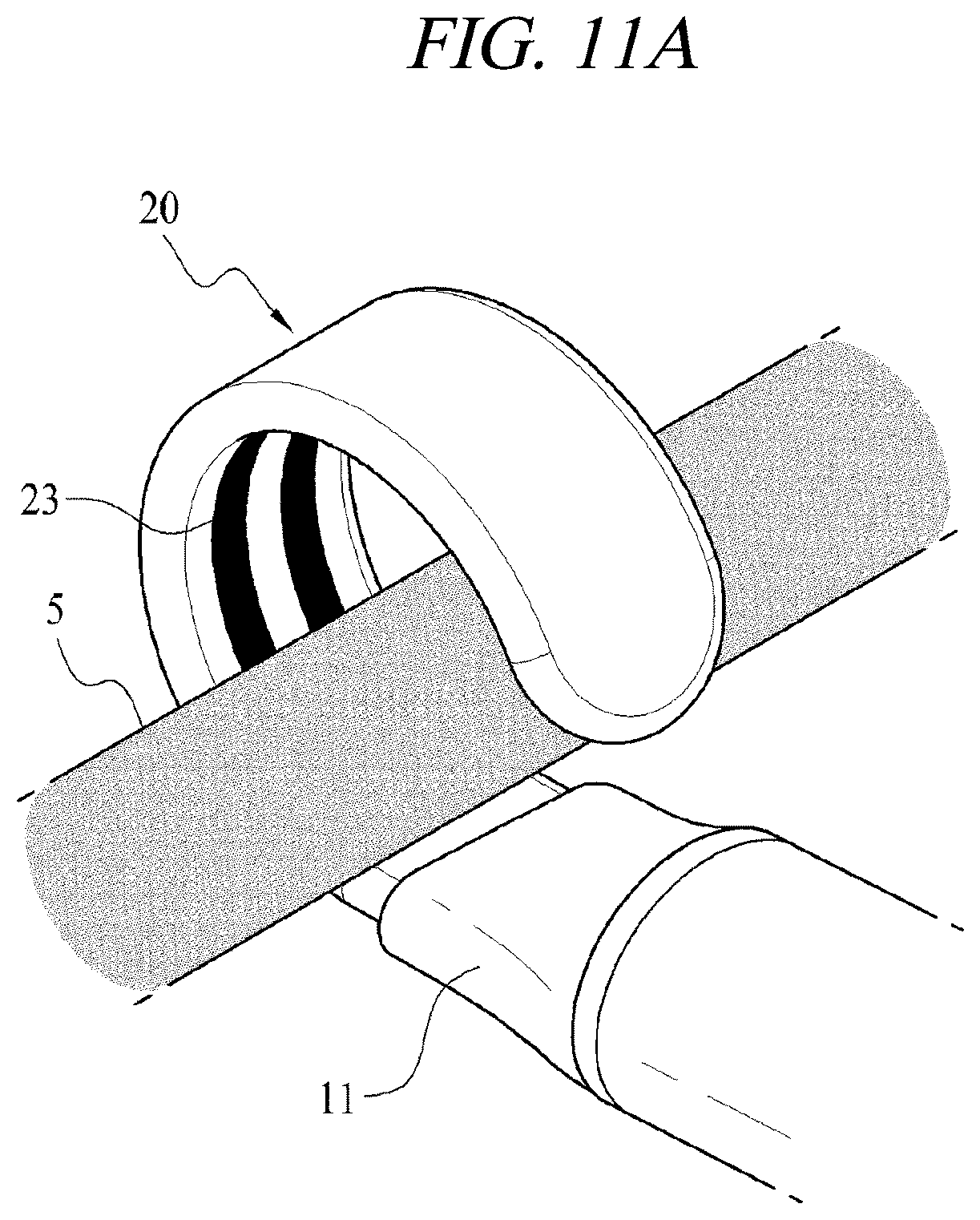 Patent US12599430 Figure 18 – Systems and methods for perivascular nerve denervation