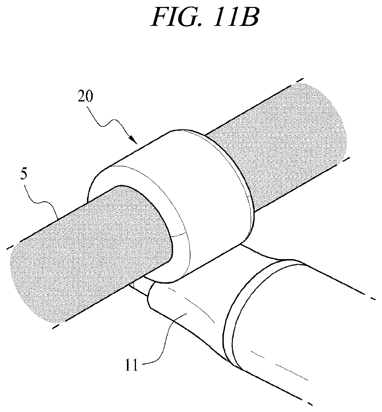 Patent US12599430 Figure 19 – Systems and methods for perivascular nerve denervation