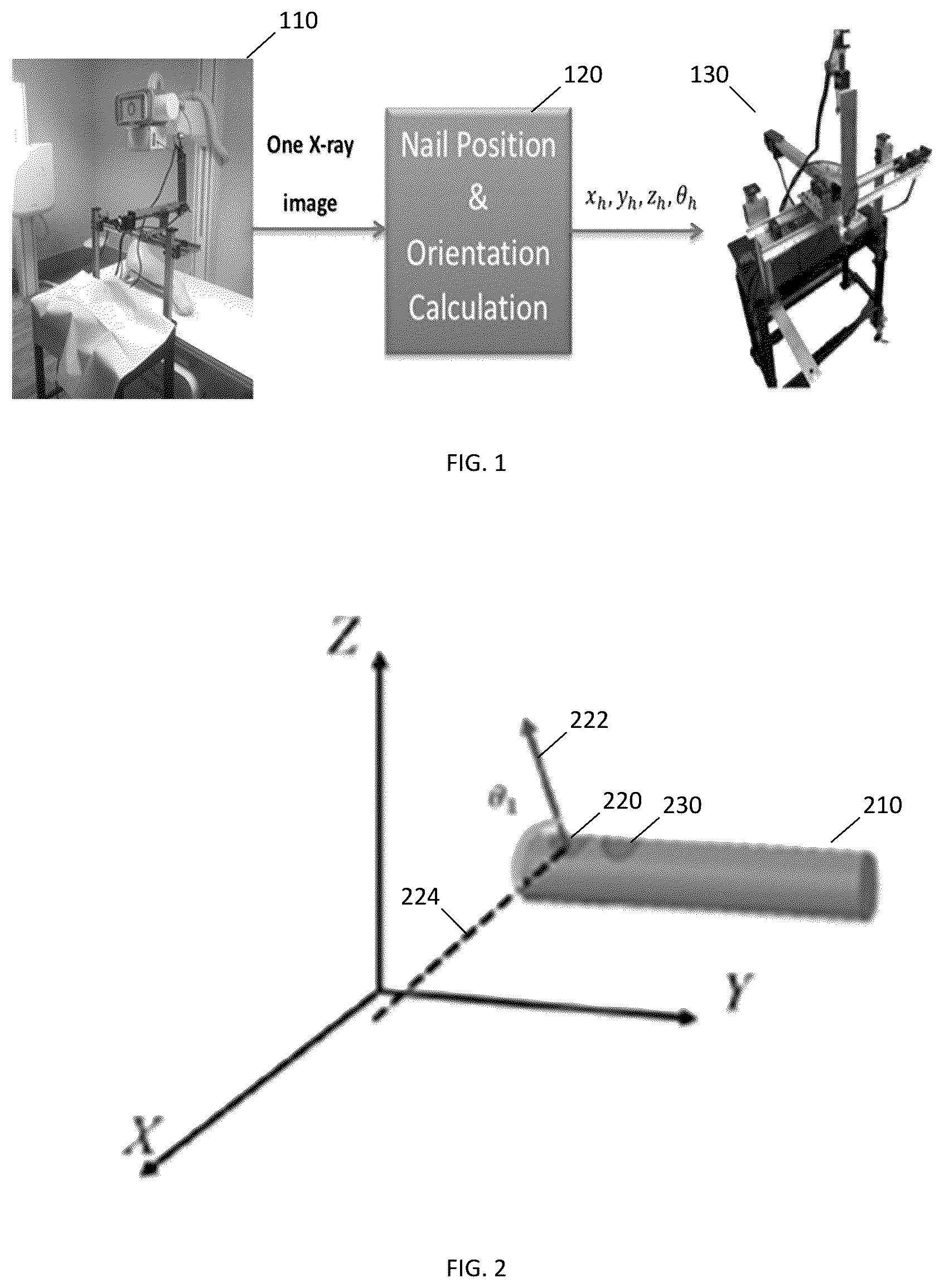 Patent US12599442 — Assistive surgical robot for distal hole localization in intramedullary nail — Figure 1