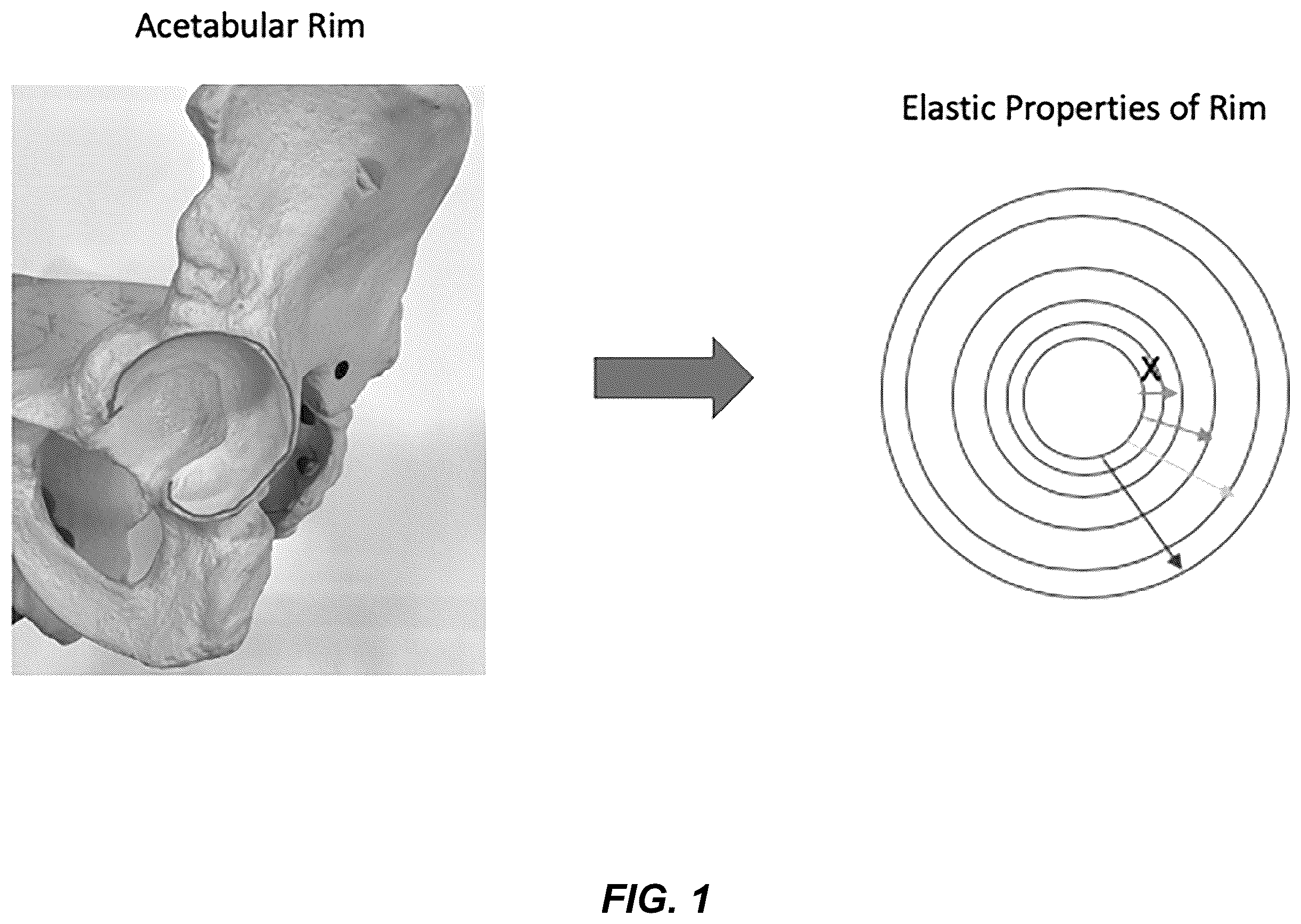 Patent US12599455 Figure 1 – Electronic signature for bone preparation