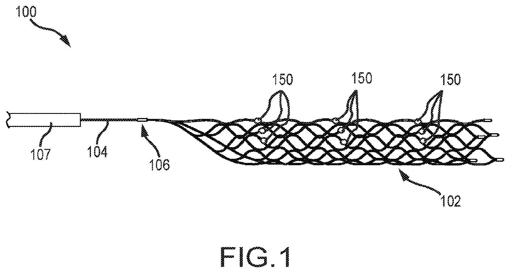 Patent US12599458 — Vascular device marker attachment — Figure 1