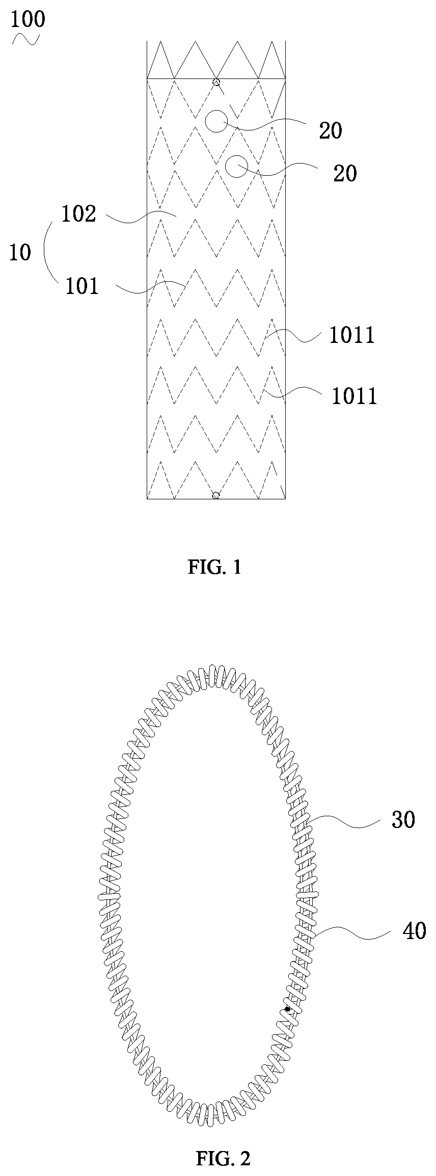Patent US12599472 Figure 1 – Covered stent