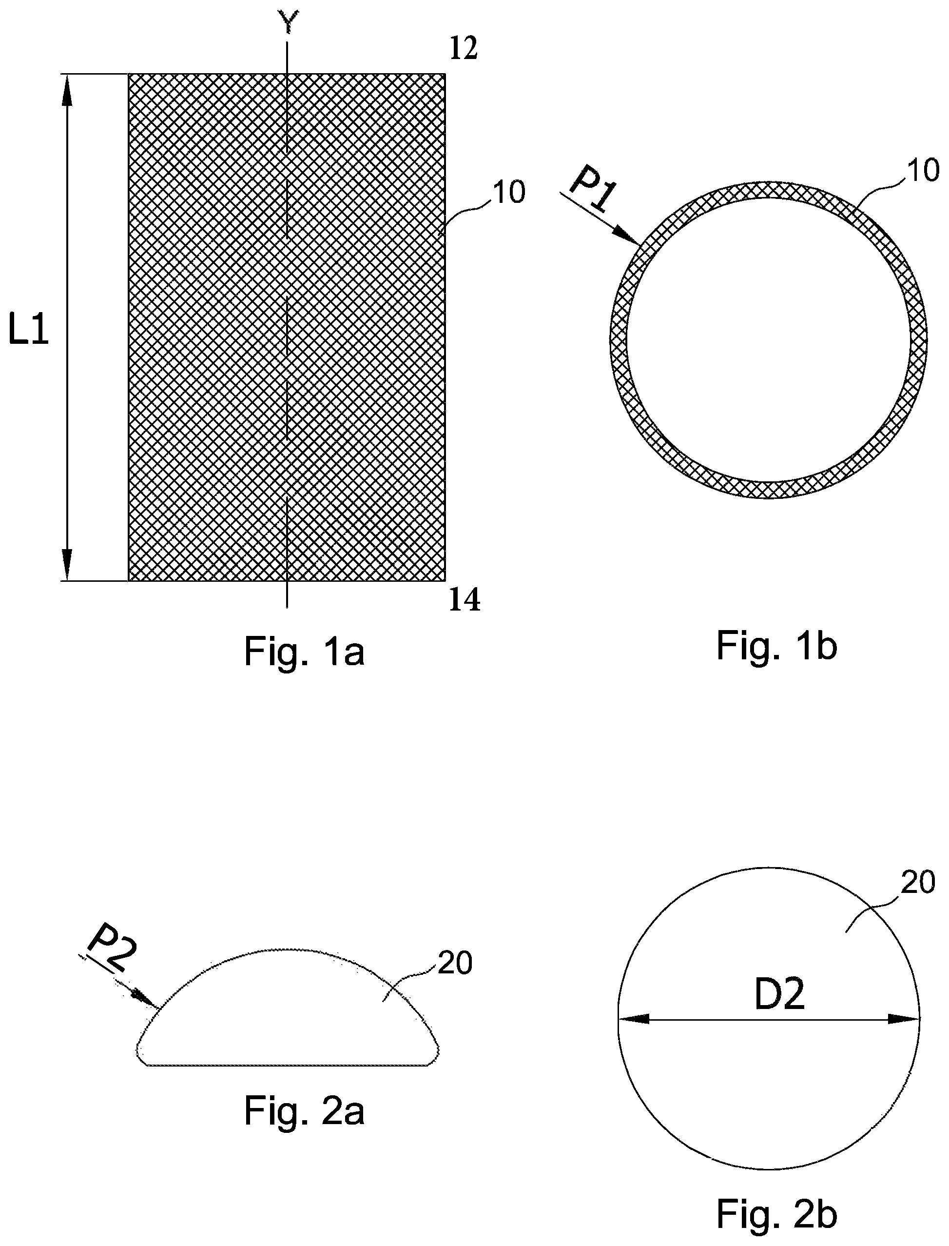 Patent US12599474 — Tubular mesh support device for a breast implant and method for preparing the breast implant — Figure 1