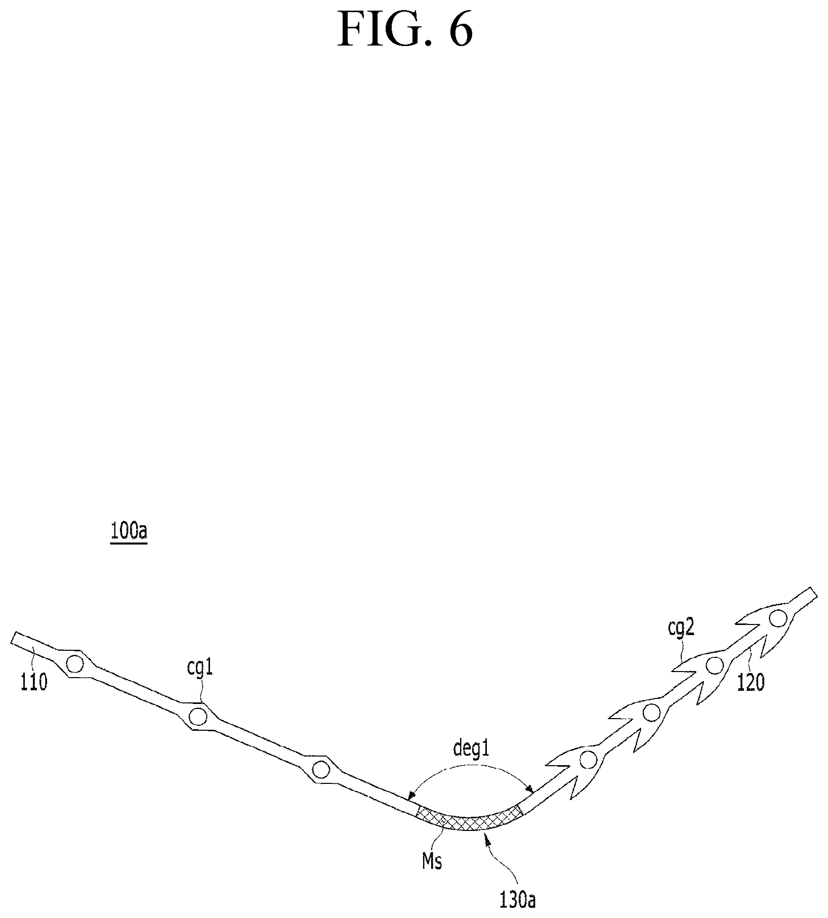 Patent US12599478 Figure 6 – Lifting suture for rhinoplasty and manufacturing method thereof