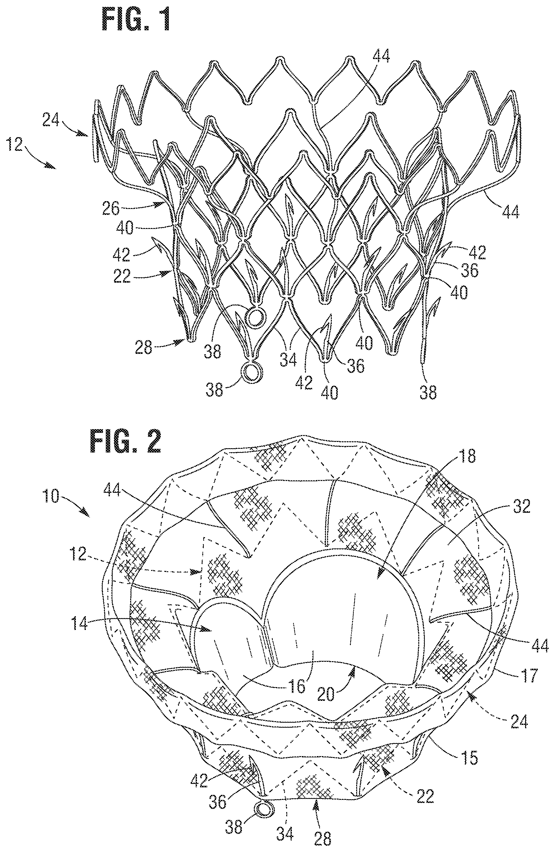 Patent US12599480 — Percutaneous mitral valve replacement device — Figure 1
