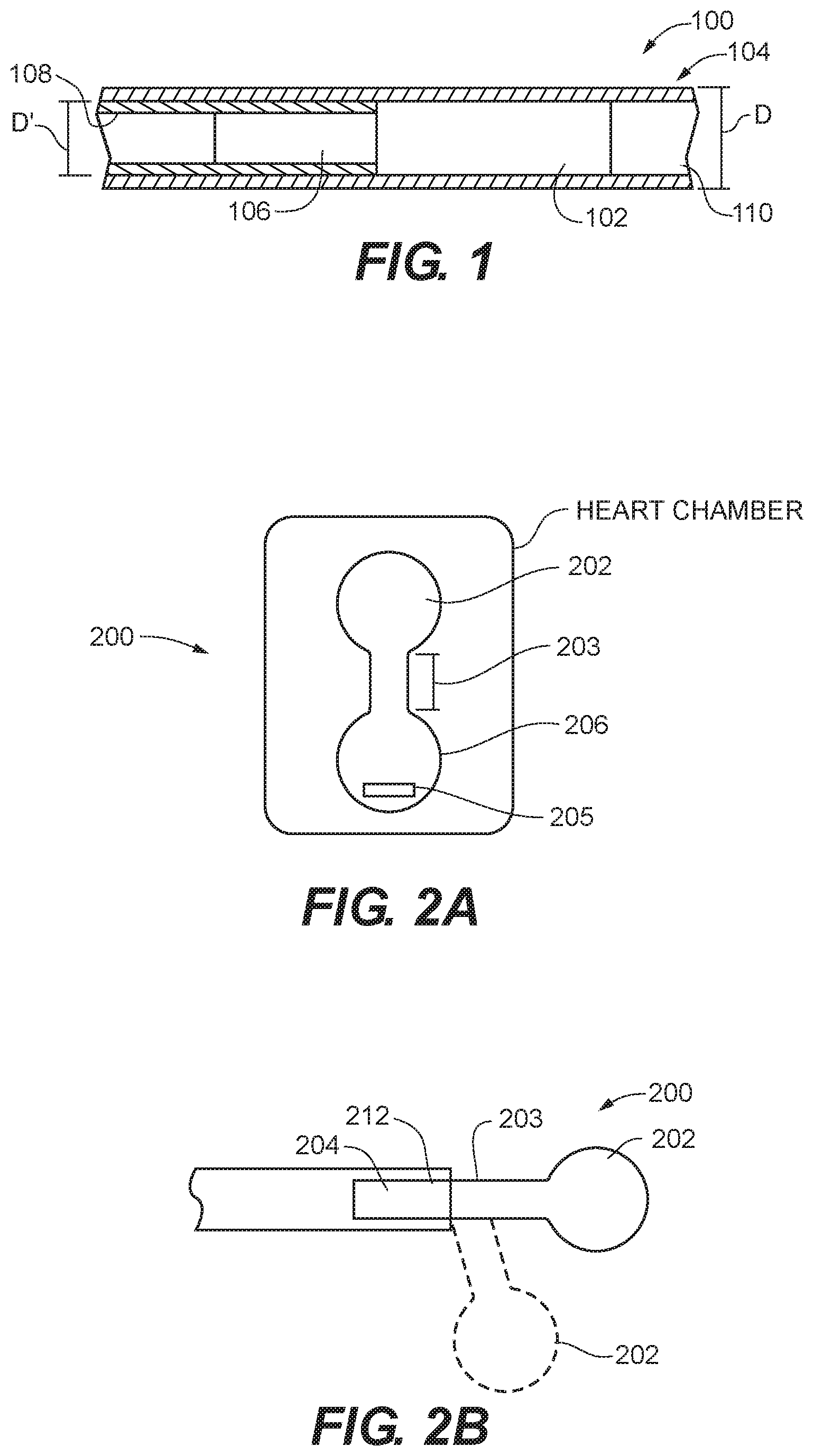 Patent US12599481 — Systems, methods and devices for delivery systems, methods and devices for implanting prosthetic heart valves — Figure 1