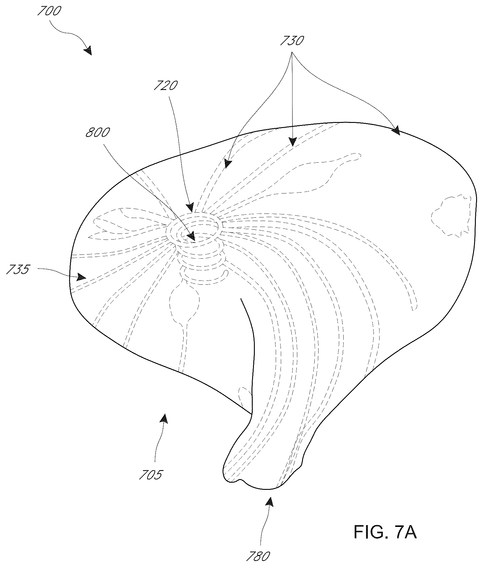 Patent US12599482 Figure 15 – Device, system, and method for transcatheter treatment of valvular regurgitation with secondary anchors