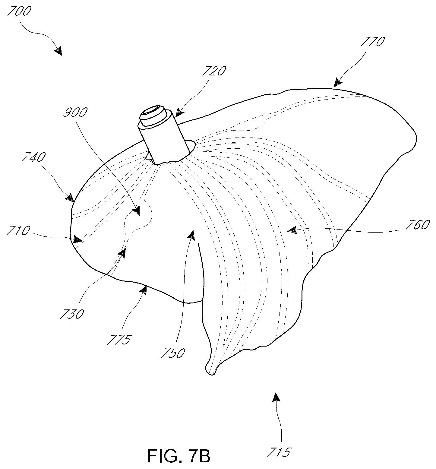 Patent US12599482 Figure 16 – Device, system, and method for transcatheter treatment of valvular regurgitation with secondary anchors