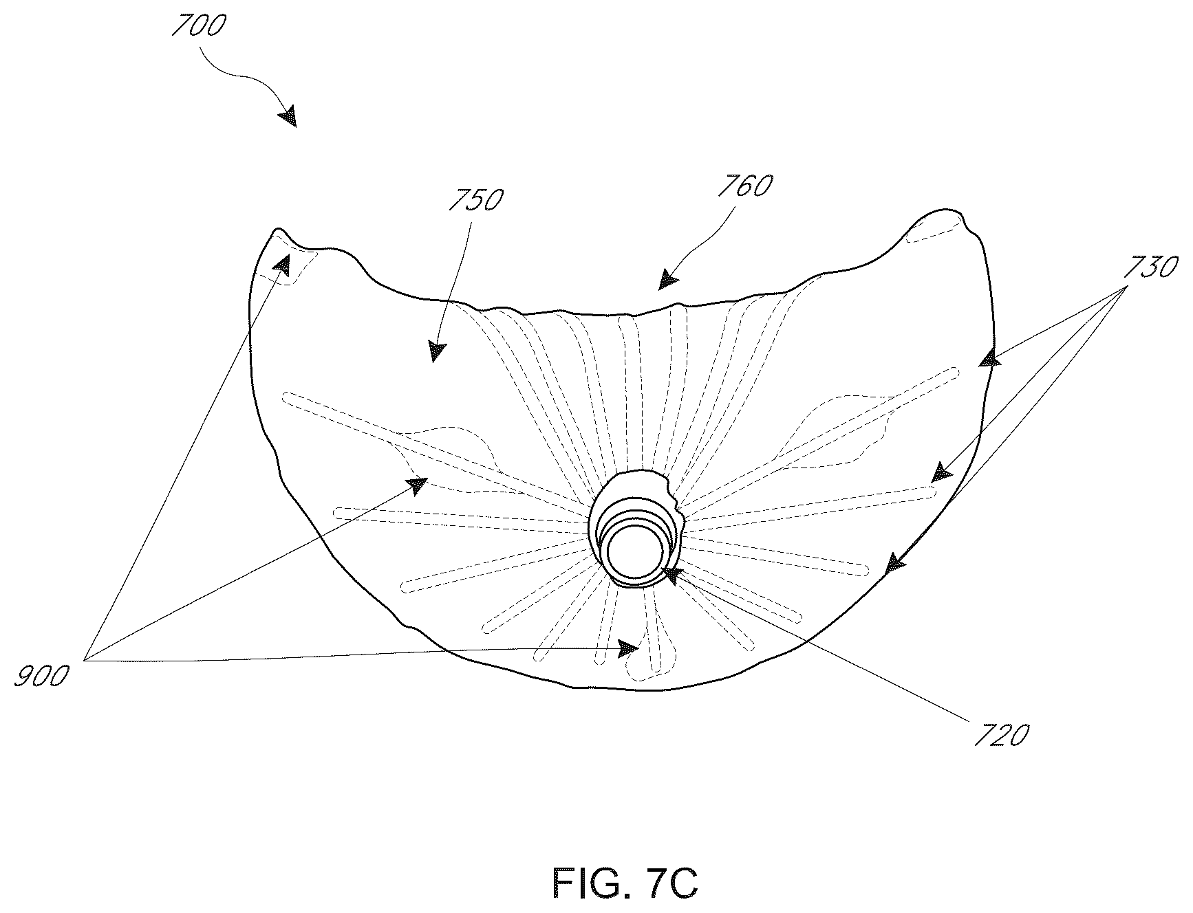 Patent US12599482 Figure 17 – Device, system, and method for transcatheter treatment of valvular regurgitation with secondary anchors