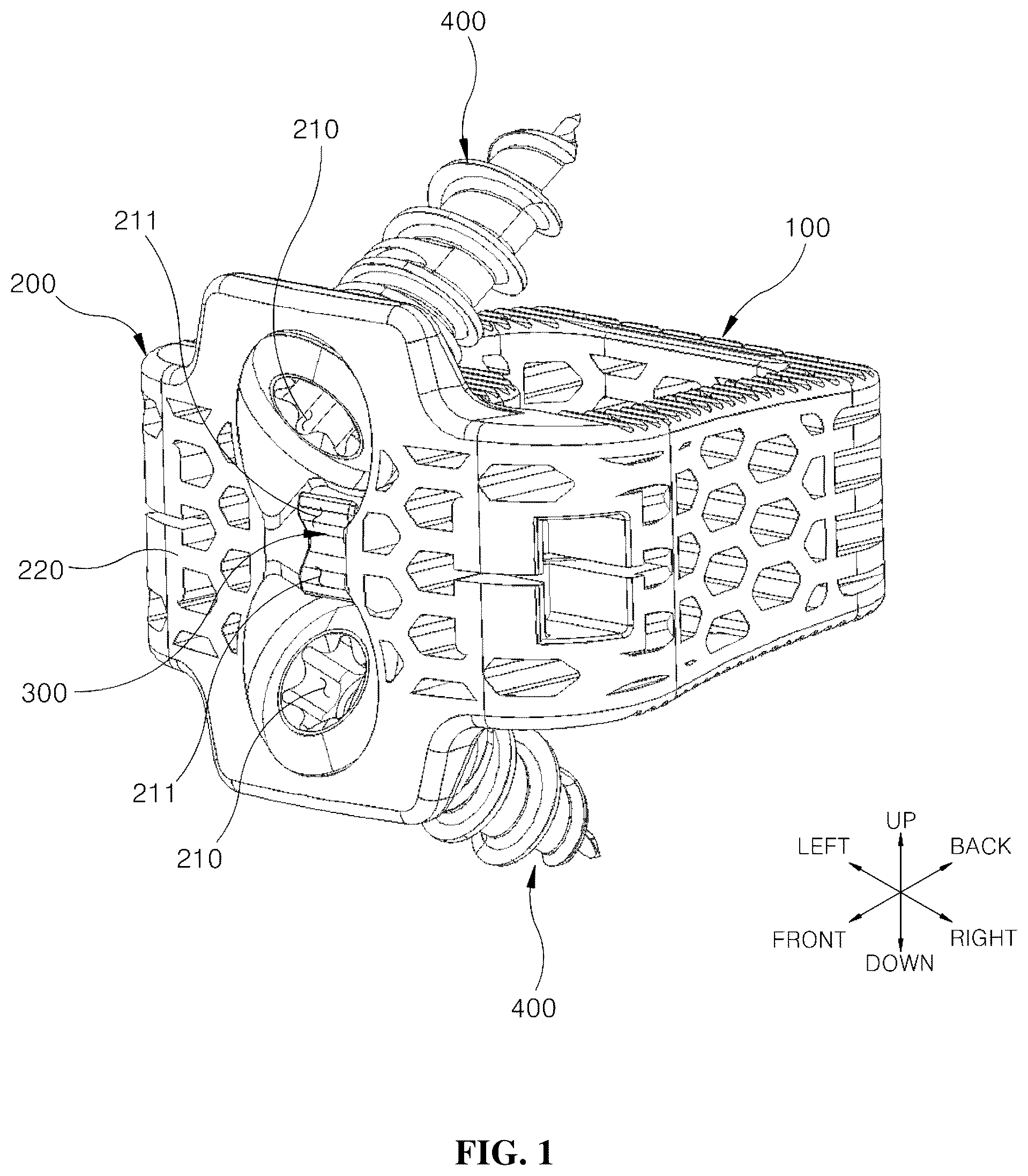 Patent US12599489 — Spinal cage fixable through insertion of bone screws — Figure 1