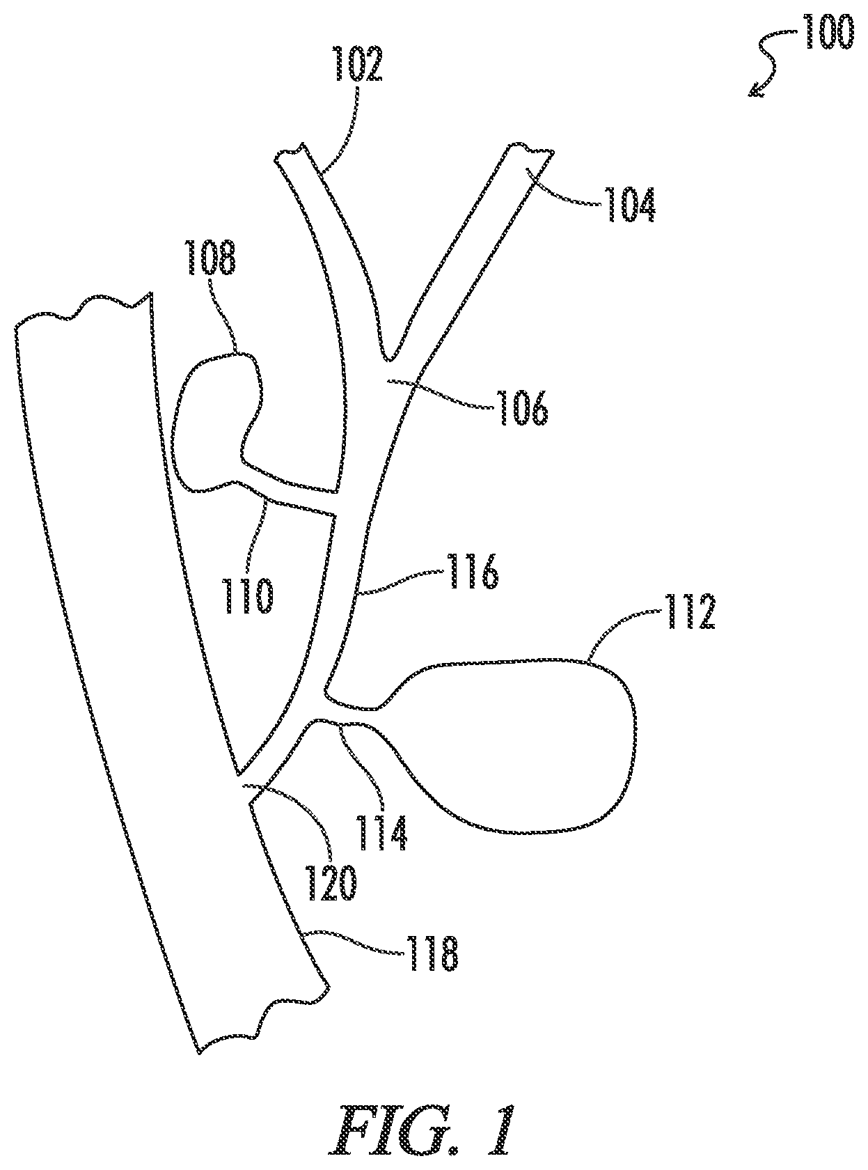 Patent US12599491 — Biliary stent — Figure 1