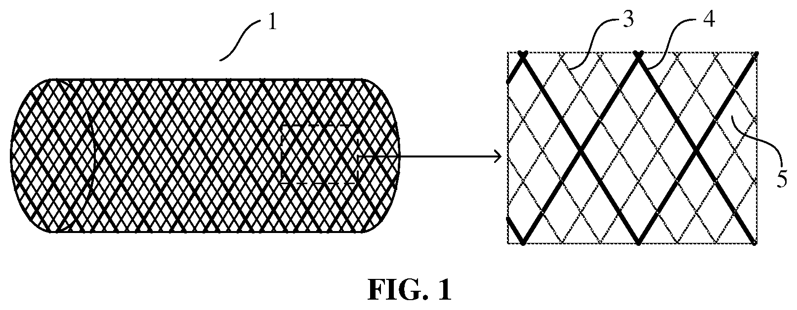 Patent US12599492 — Axially compressible bare stent — Figure 1