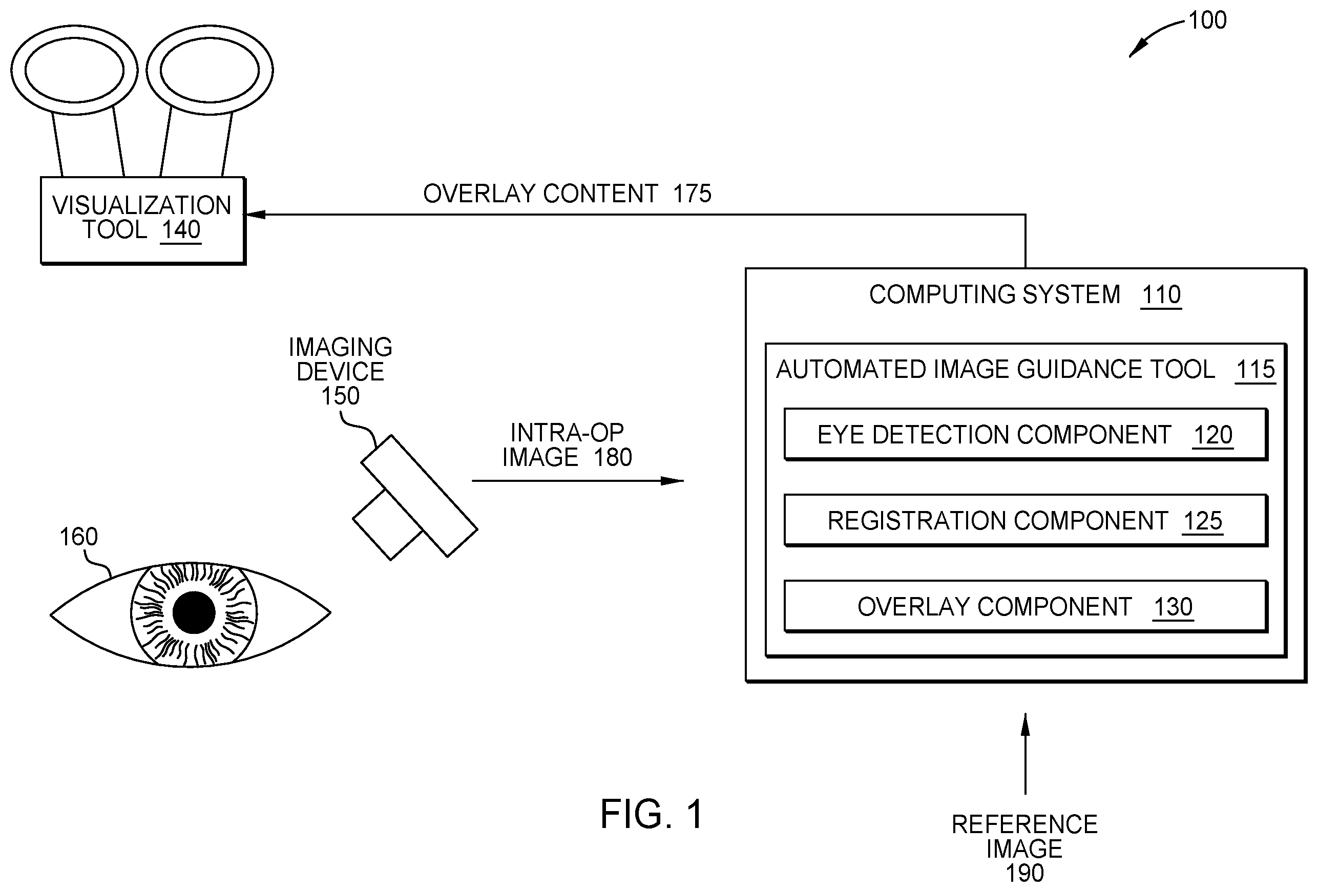 Patent US12599498 — Automated image guidance for ophthalmic surgery — Figure 1