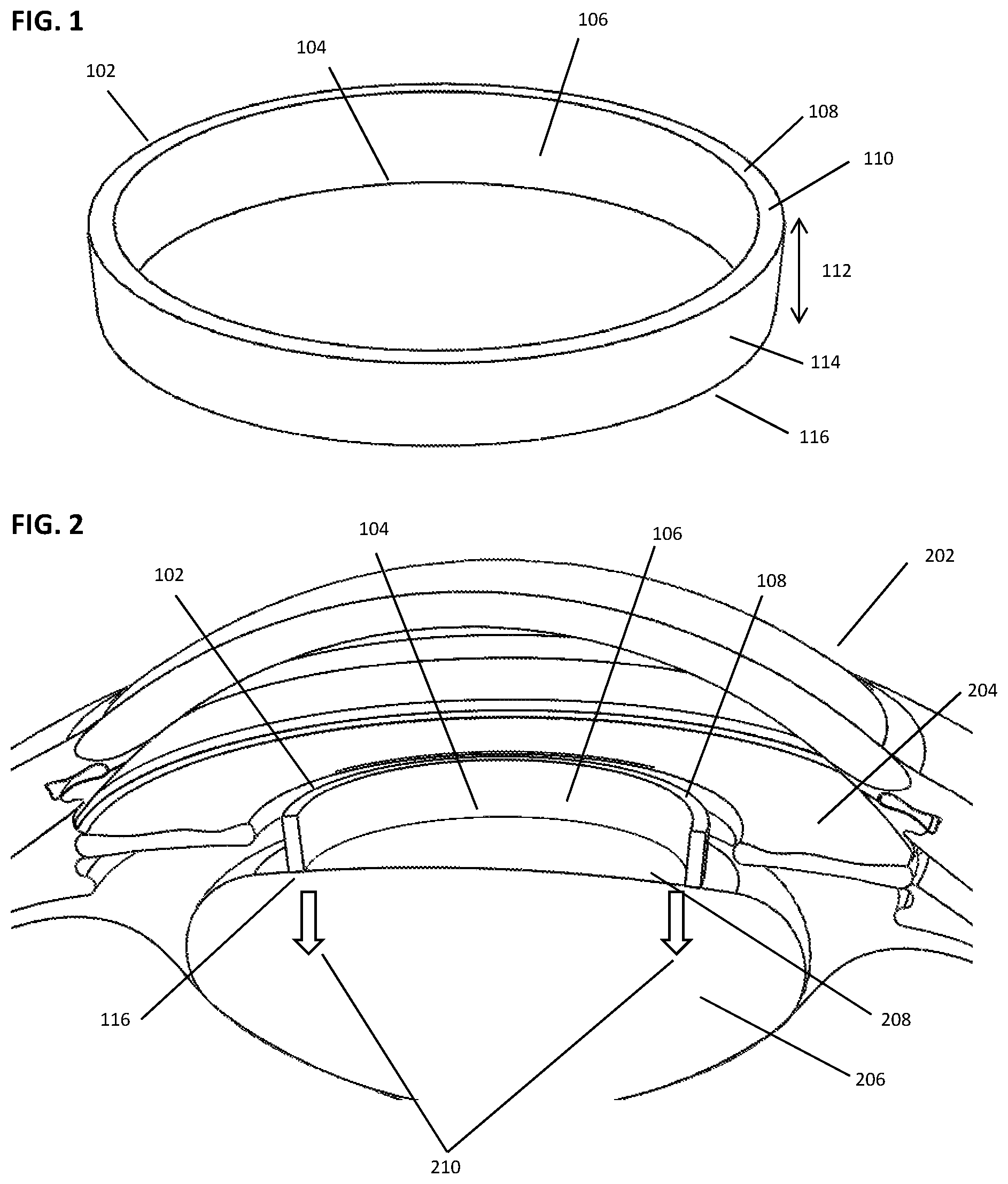 Patent US12599499 — Devices and methods for creating a capsulorhexis — Figure 1