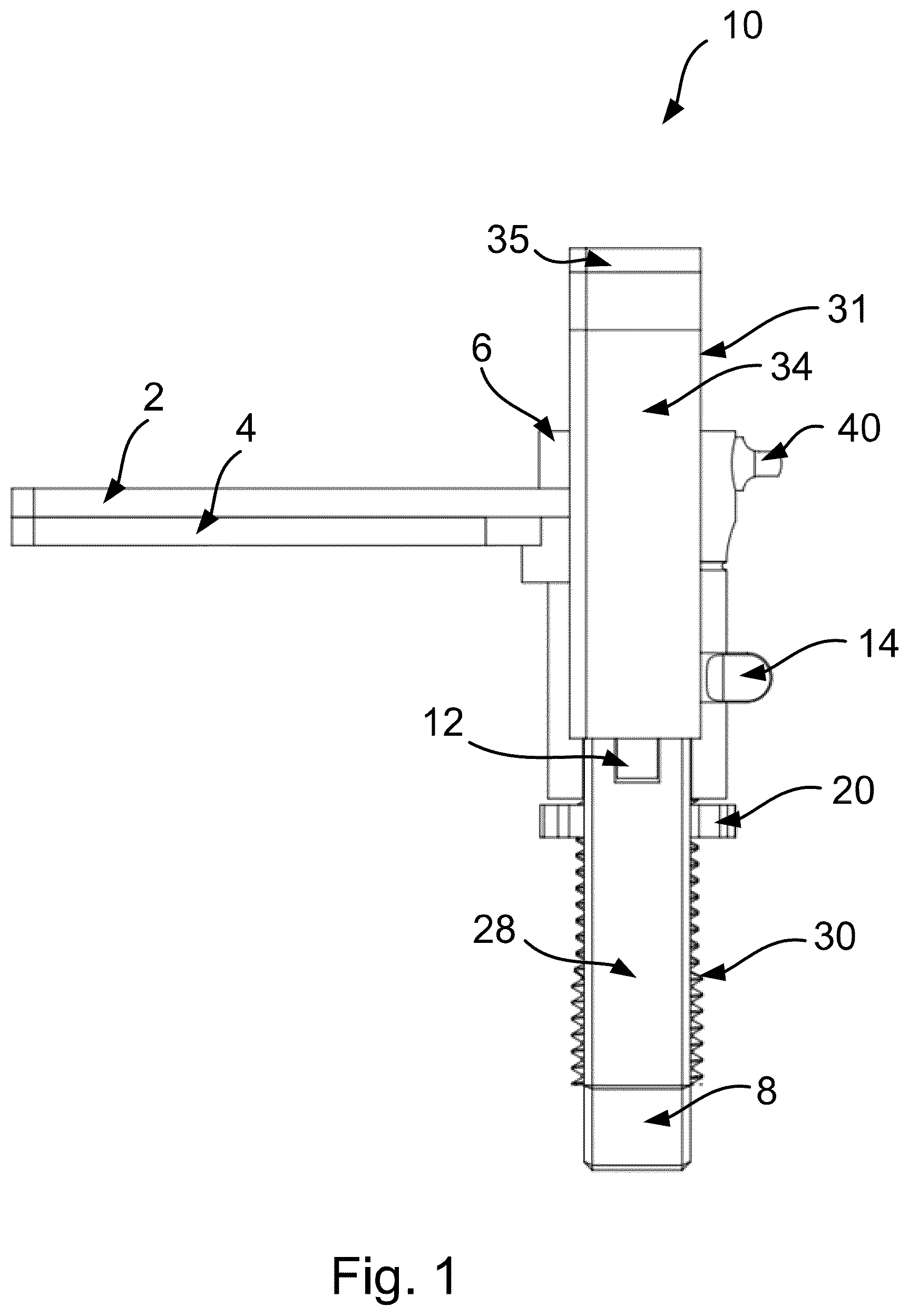 Patent US12599528 Figure 1 – Unicondylar balancer and method