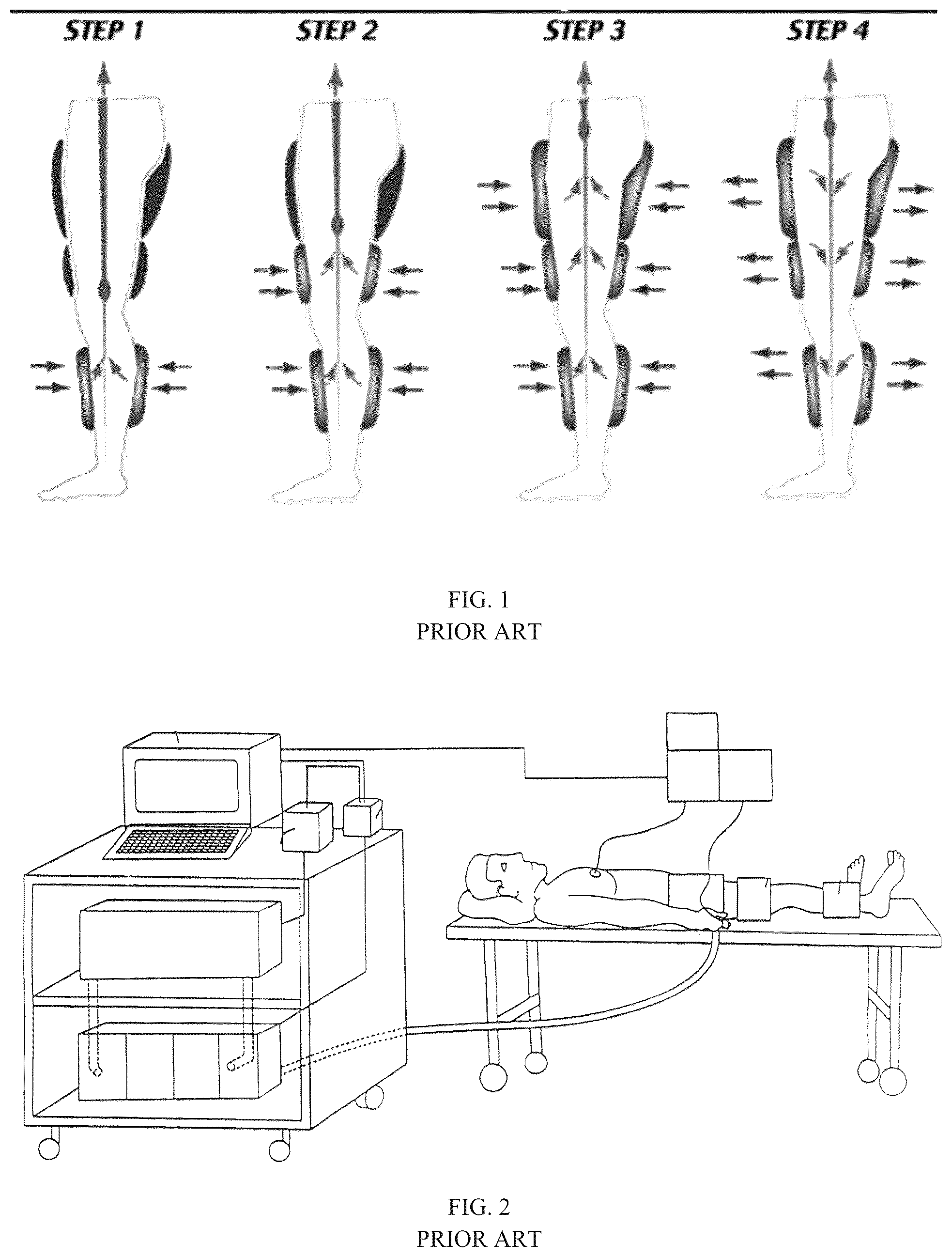 Patent US12599535 — External counterpulsation system — Figure 1