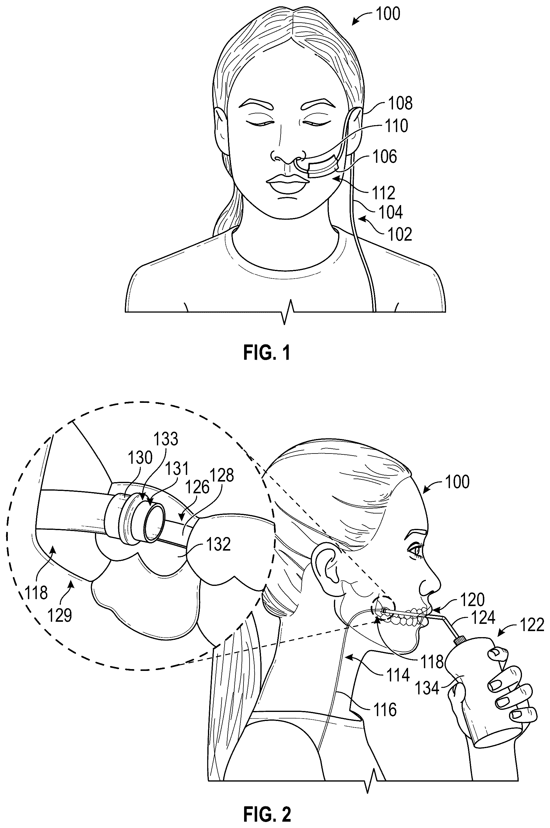 Patent US12599544 — Intraoral gastrointestinal access device and related methods — Figure 1