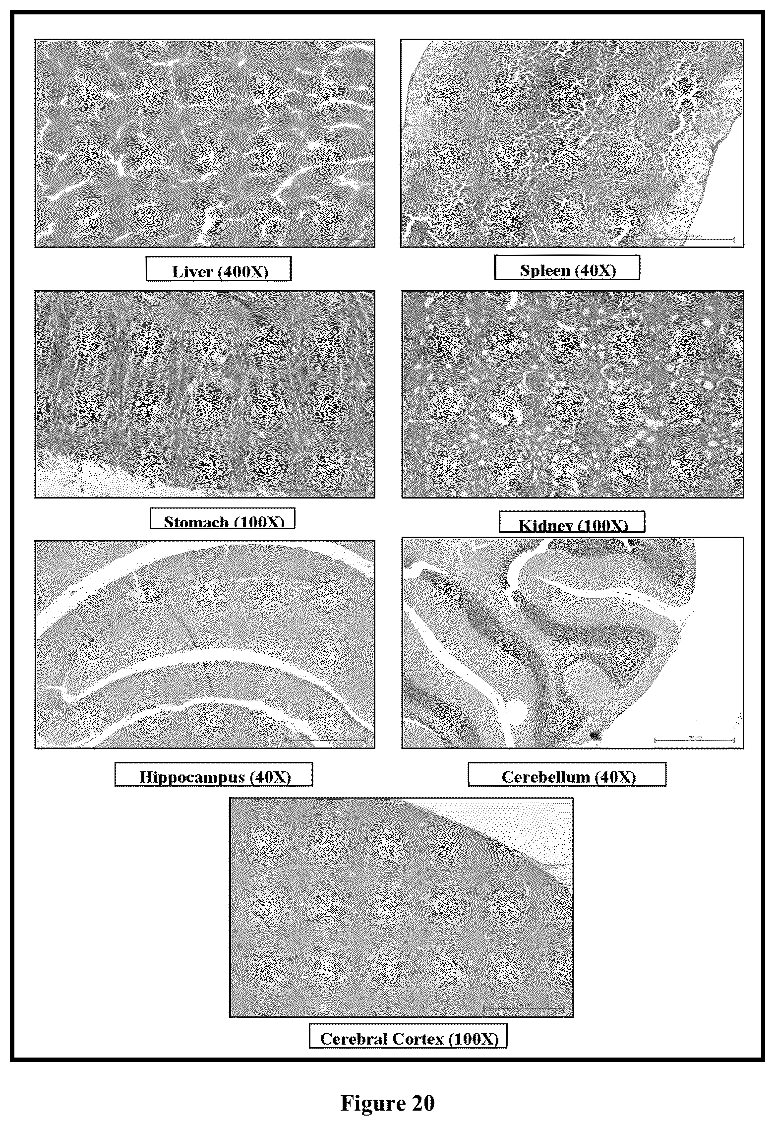 Patent US12599572 Figure 14 – Solid lipid nanoparticles of curcumin