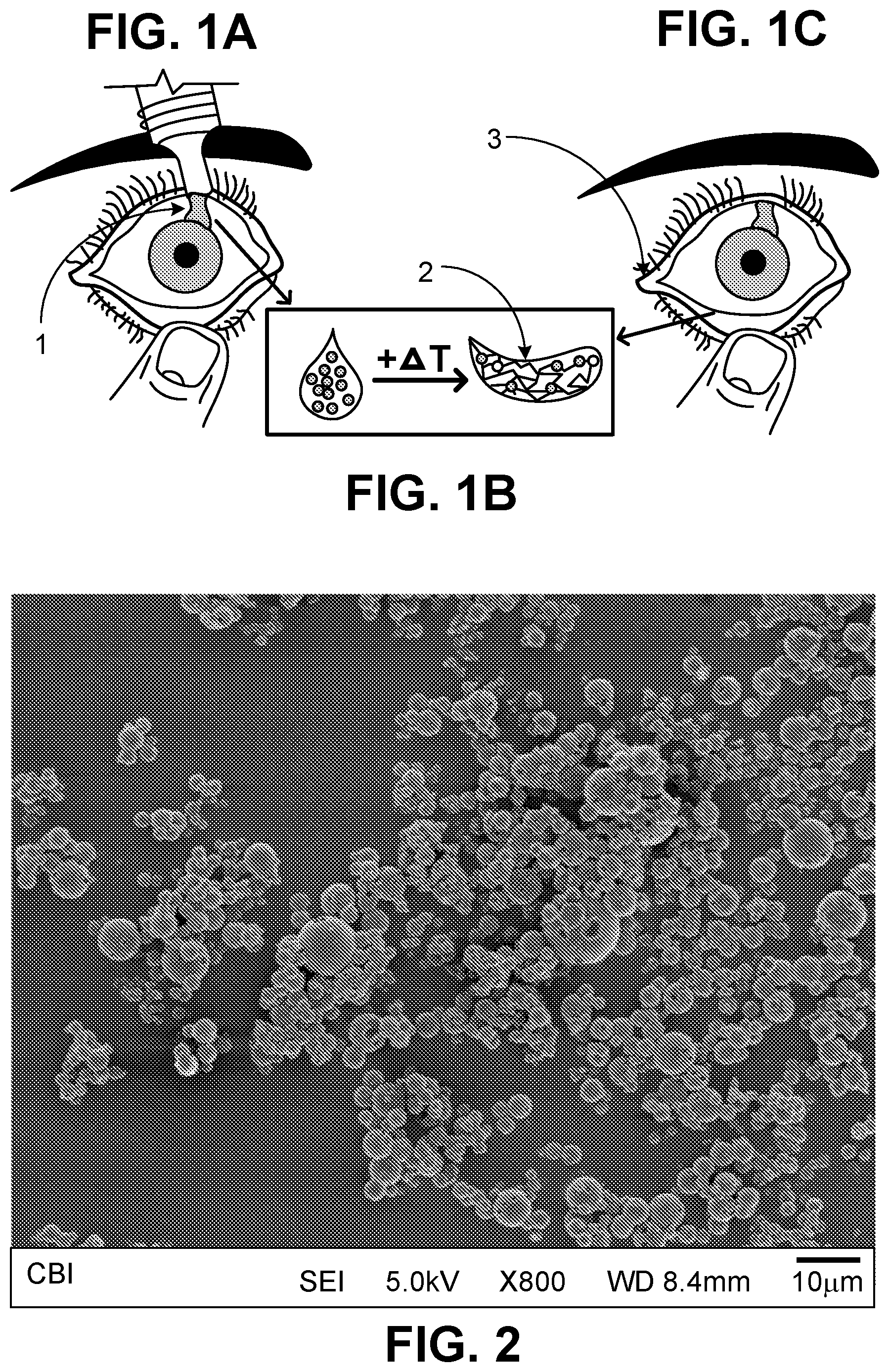 Patent US12599577 — Thermoresponsive gel eye drop for ocular delivery of cysteamine — Figure 1