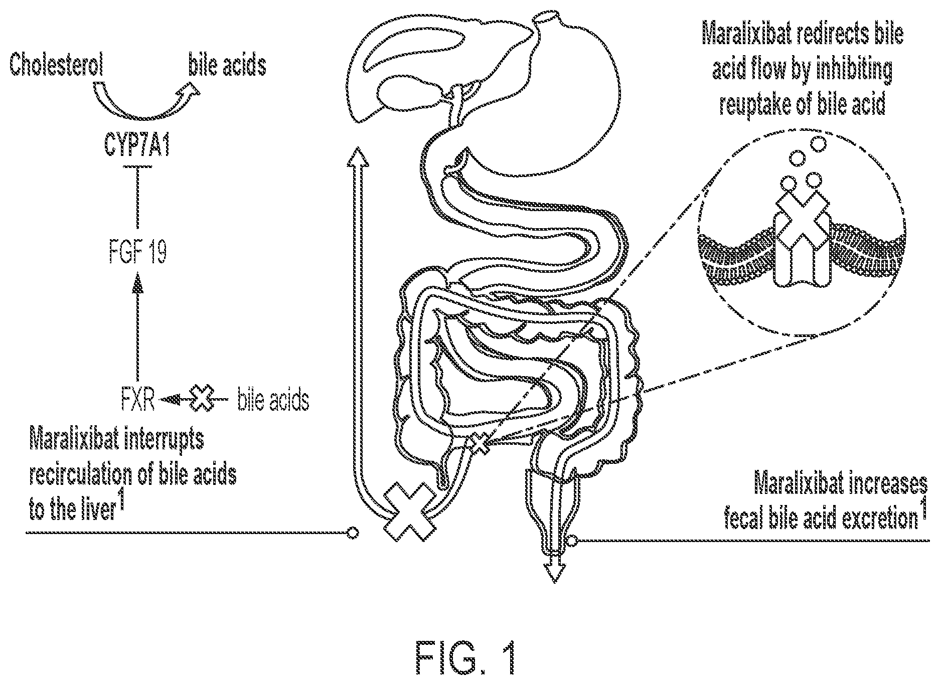 Patent US12599602 — Methods for treating cholestasis — Figure 1