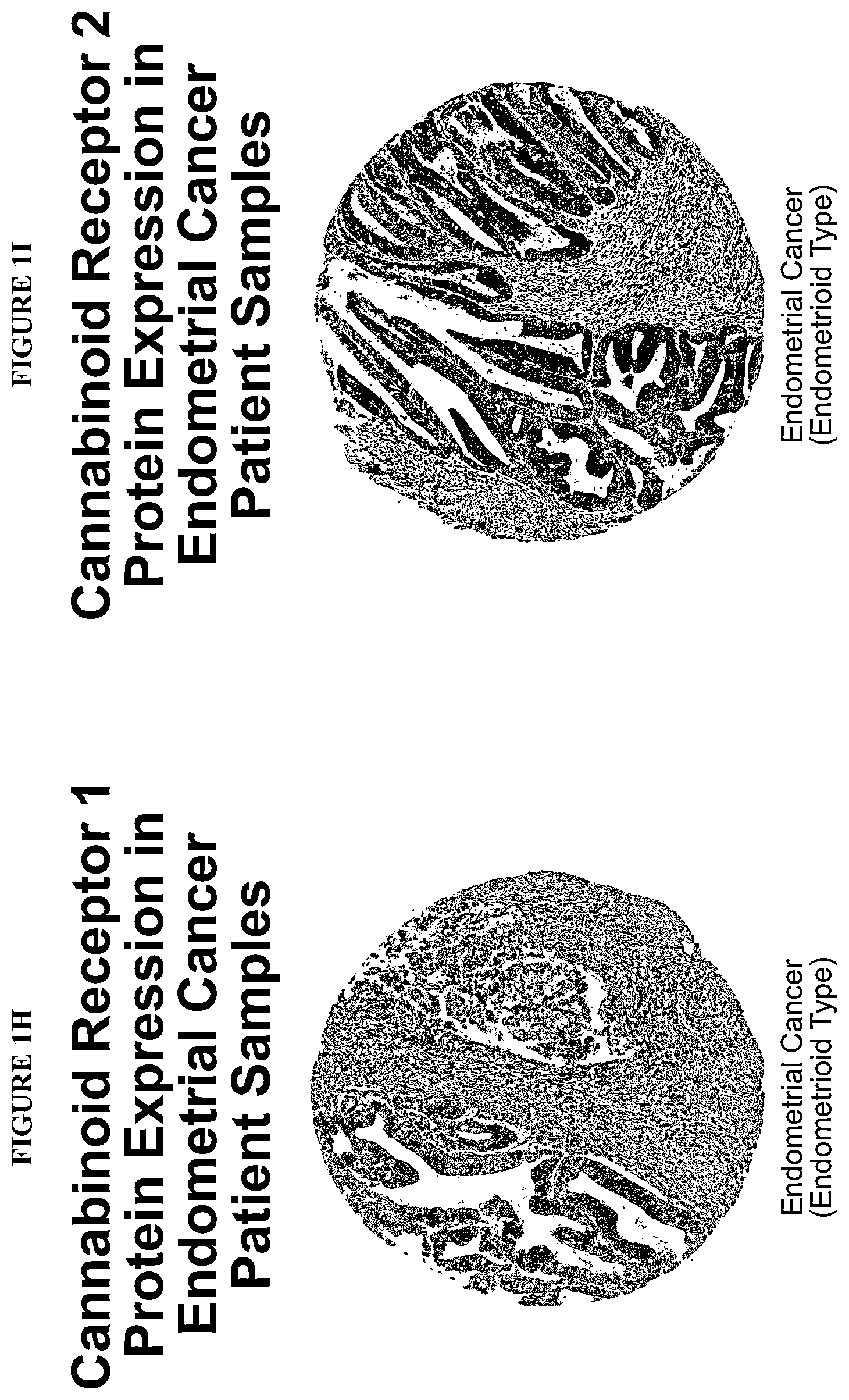 Patent US12599617 Figure 5 – Methods of treating head and neck cancers with hemp extract