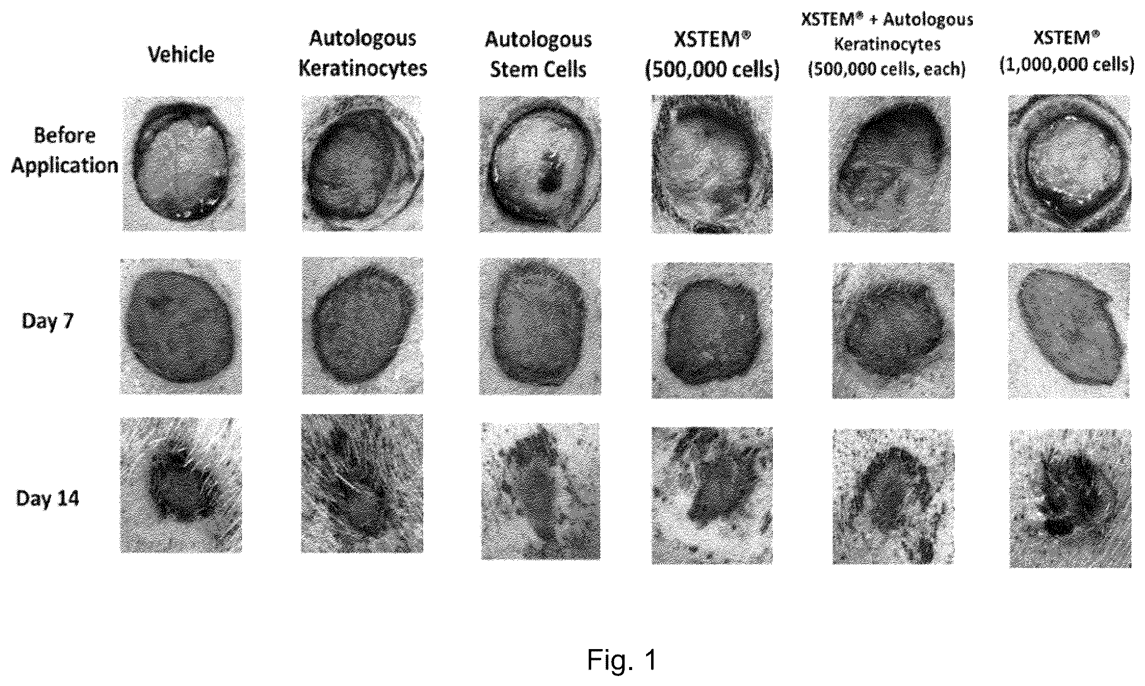 Patent US12599633 — Mesenchymal stem cells for use in the treatment of skin defects — Figure 1