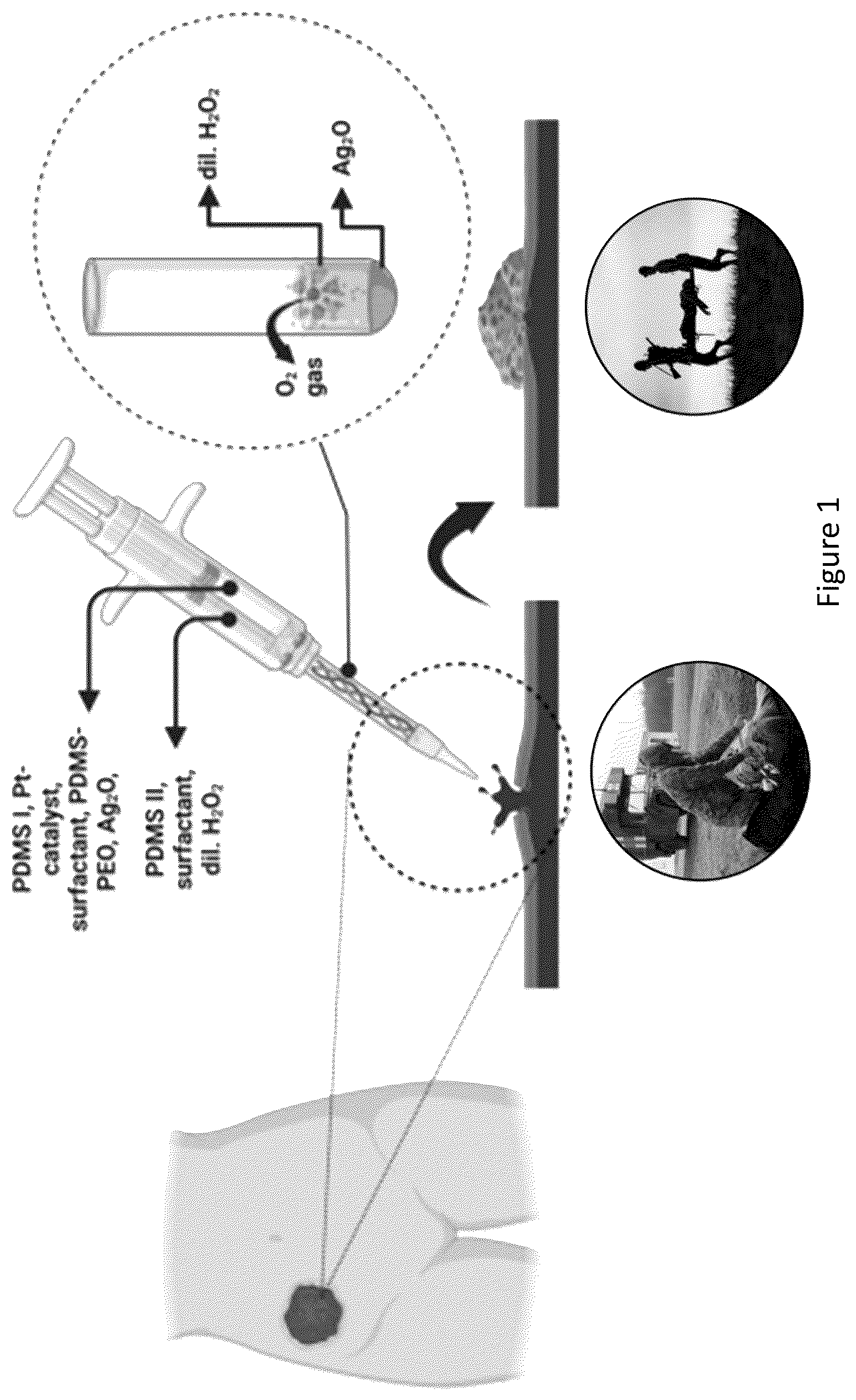 Patent US12599693 — Augmented thermoset polymer sponges for in situ hemostatic treatment of external and internal wounds — Figure 1