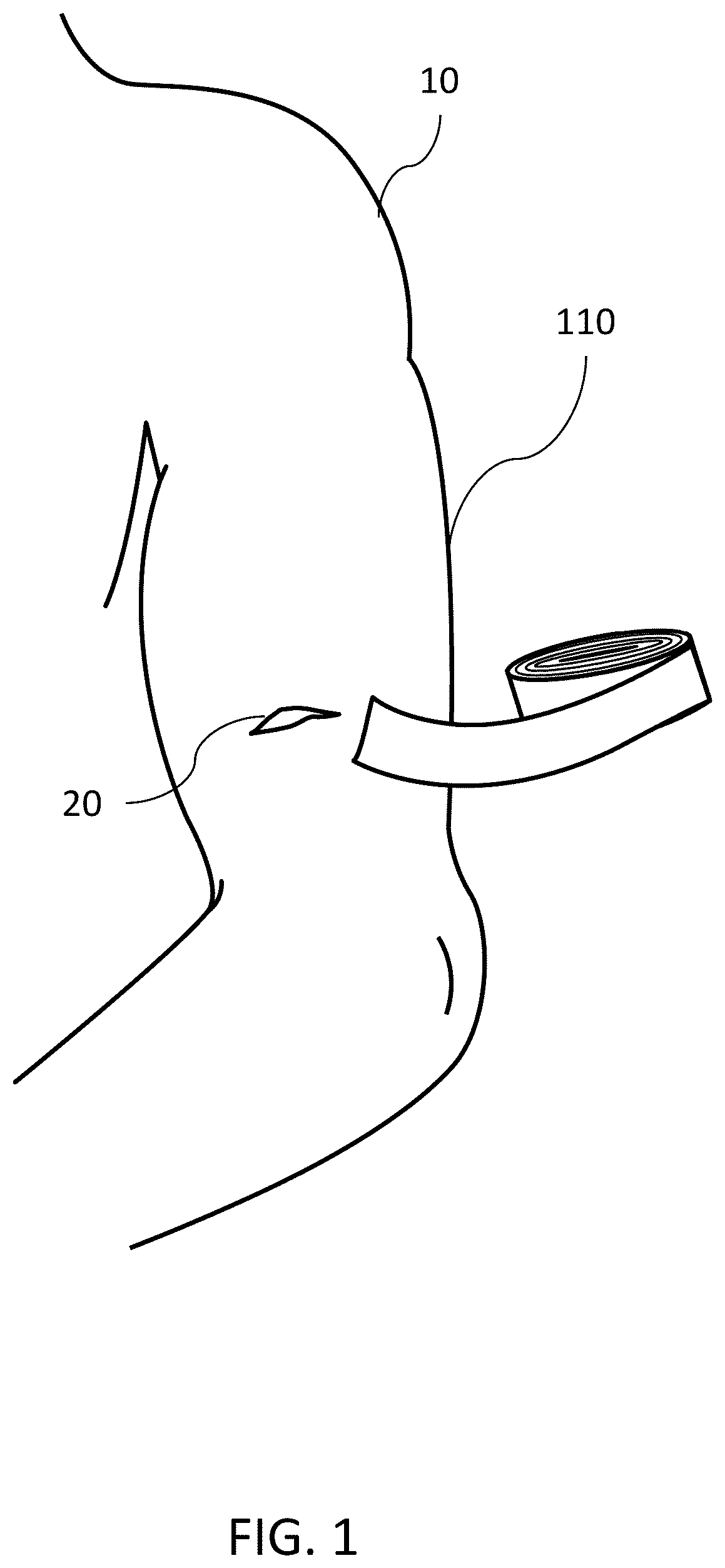 Patent US12599694 — Scaffold wound dressing — Figure 1