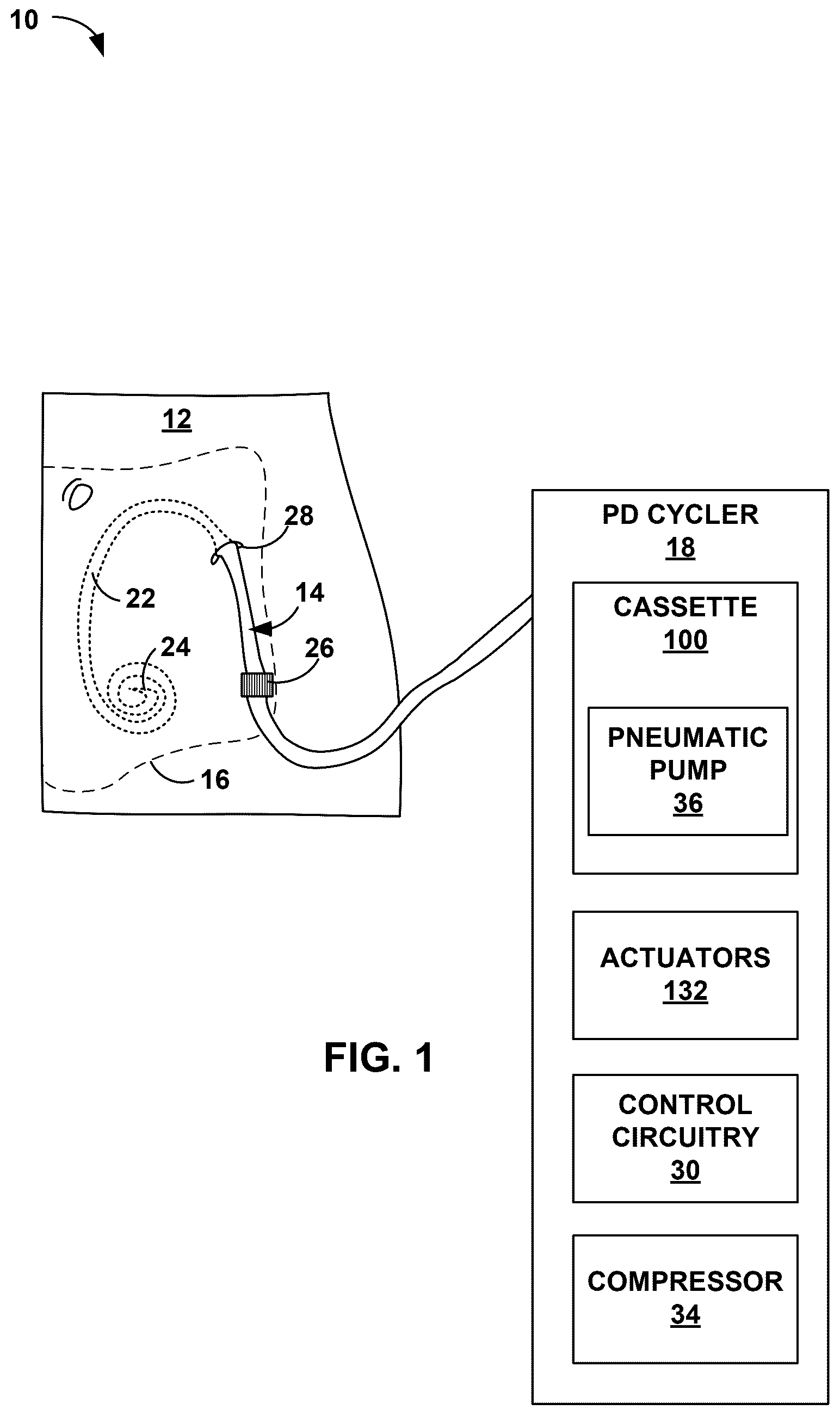 Patent US12599708 — Peritoneal dialysis cassette — Figure 1